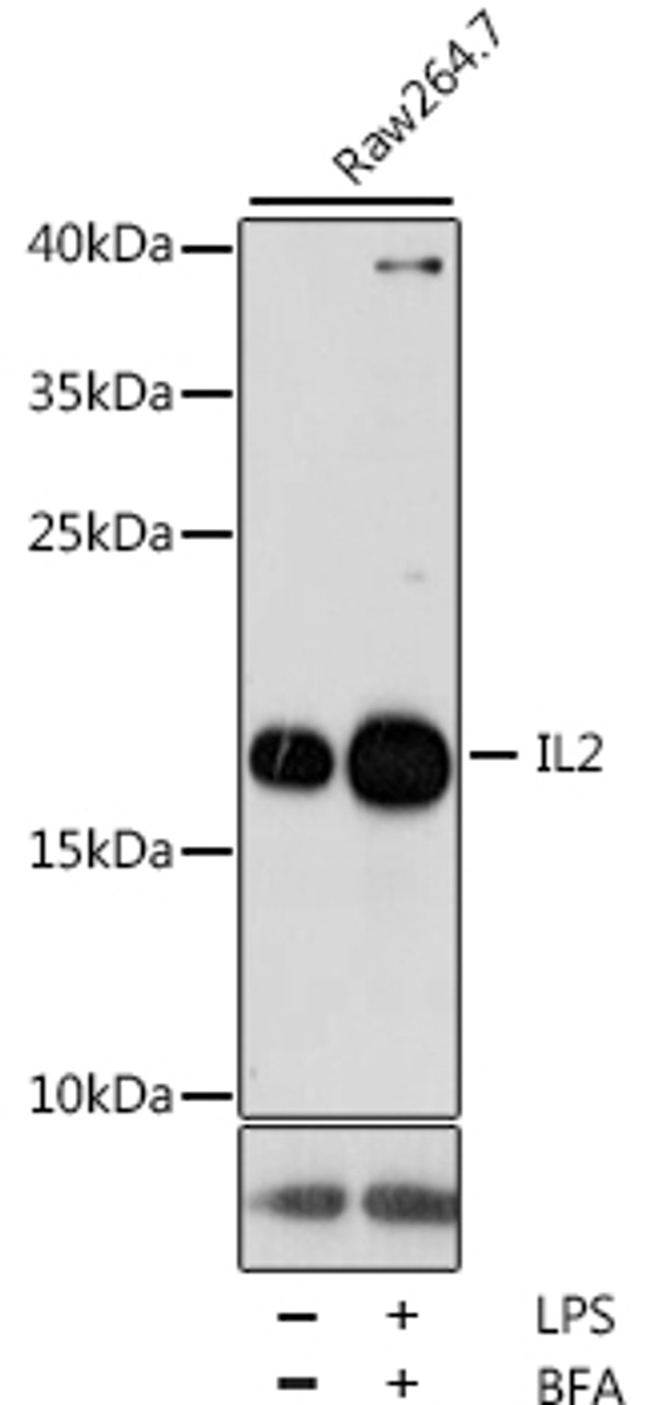 Western blot analysis of extracts of Raw264.7 cells, using IL2 antibody (16-547) at 1:1000 dilution. Raw264.7 cells were treated by LPS for 6 hours and Brefeldin A for 3 hours of stimulation.<br/>Secondary antibody: HRP Goat Anti-Rabbit IgG (H+L) at 1:10000 dilution.<br/>Lysates/proteins: 25ug per lane.<br/>Blocking buffer: 3% nonfat dry milk in TBST.<br/>Detection: ECL Basic Kit.<br/>Exposure time: 30s.
