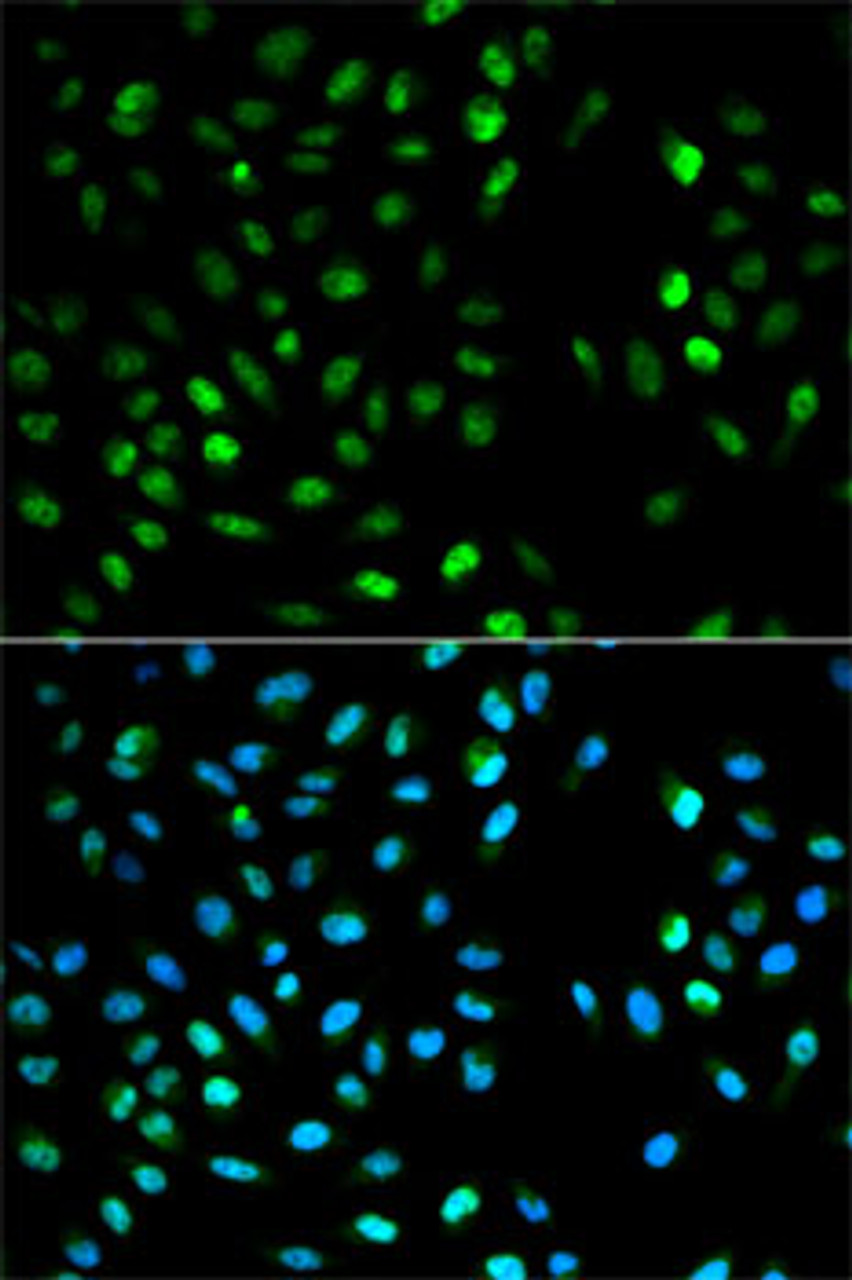 Immunofluorescence analysis of HeLa cells using DTNBP1 antibody (16-550) . Blue: DAPI for nuclear staining.