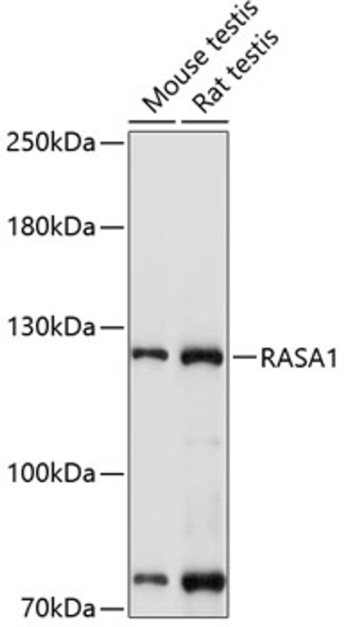 Western blot analysis of extracts of various cell lines, using RASA1 antibody (16-559) at 1:1000 dilution.<br/>Secondary antibody: HRP Goat Anti-Rabbit IgG (H+L) at 1:10000 dilution.<br/>Lysates/proteins: 25ug per lane.<br/>Blocking buffer: 3% nonfat dry milk in TBST.<br/>Detection: ECL Basic Kit.<br/>Exposure time: 30s.