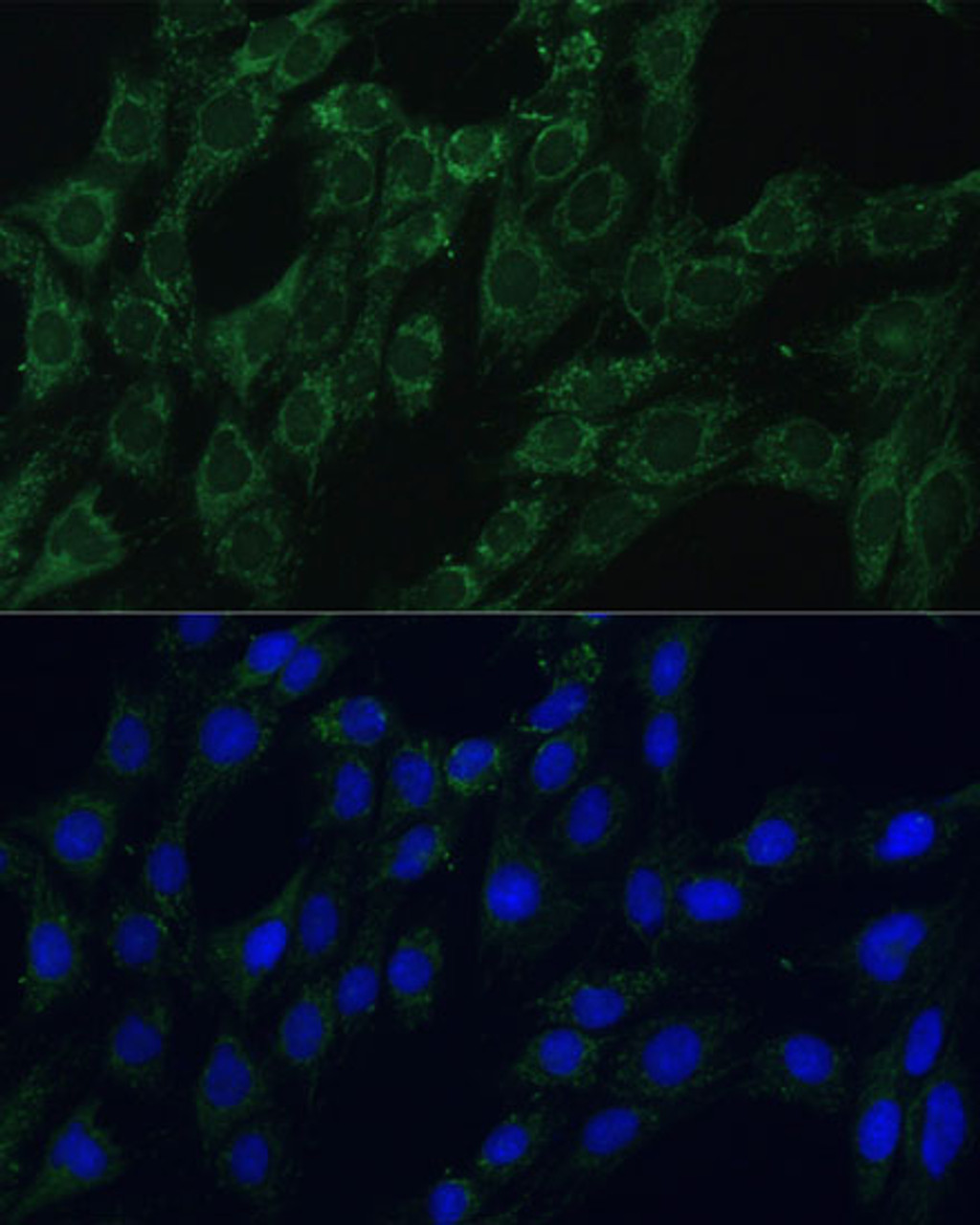 Immunofluorescence analysis of C6 cells using AEBP1 Polyclonal Antibody (16-560) at dilution of 1:100 (40x lens) . Blue: DAPI for nuclear staining.