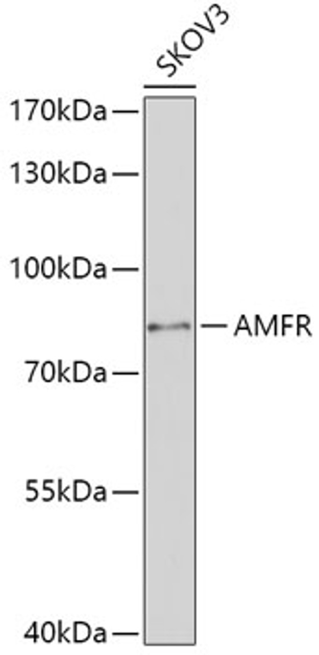Western blot analysis of extracts of SKOV3 cells, using AMFR antibody (16-563) at 1:1000 dilution.<br/>Secondary antibody: HRP Goat Anti-Rabbit IgG (H+L) at 1:10000 dilution.<br/>Lysates/proteins: 25ug per lane.<br/>Blocking buffer: 3% nonfat dry milk in TBST.<br/>Detection: ECL Basic Kit.<br/>Exposure time: 90s.