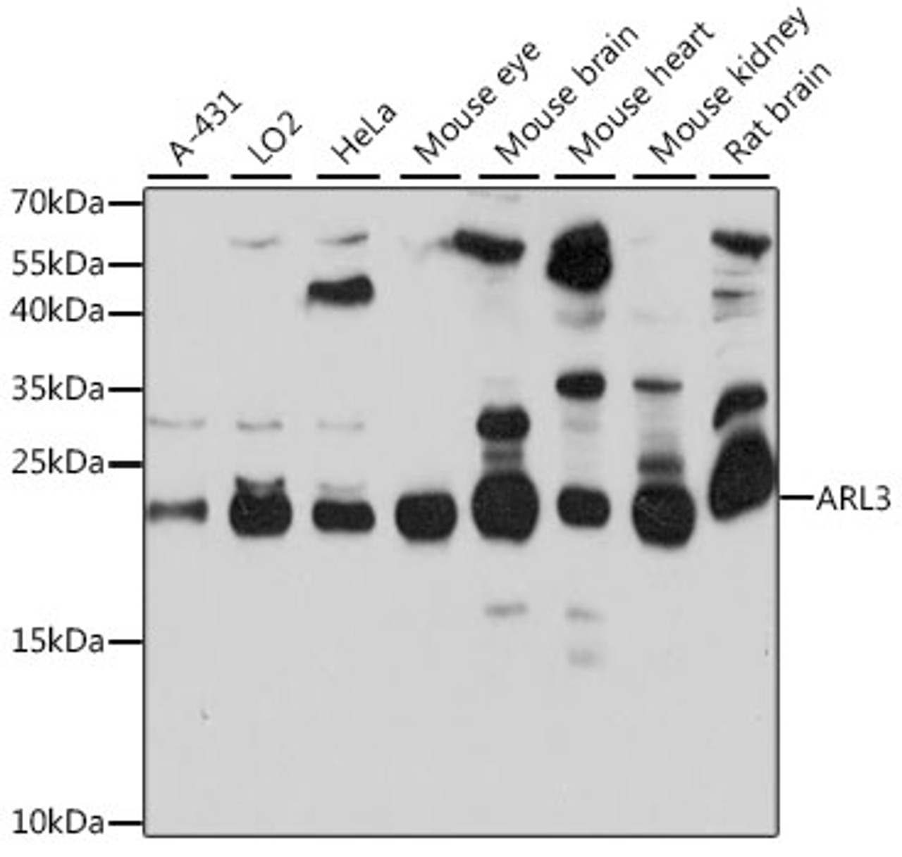 Western blot analysis of extracts of various cell lines, using ARL3 antibody (16-564) at 1:1000 dilution.<br/>Secondary antibody: HRP Goat Anti-Rabbit IgG (H+L) at 1:10000 dilution.<br/>Lysates/proteins: 25ug per lane.<br/>Blocking buffer: 3% nonfat dry milk in TBST.<br/>Detection: ECL Basic Kit.<br/>Exposure time: 30s.