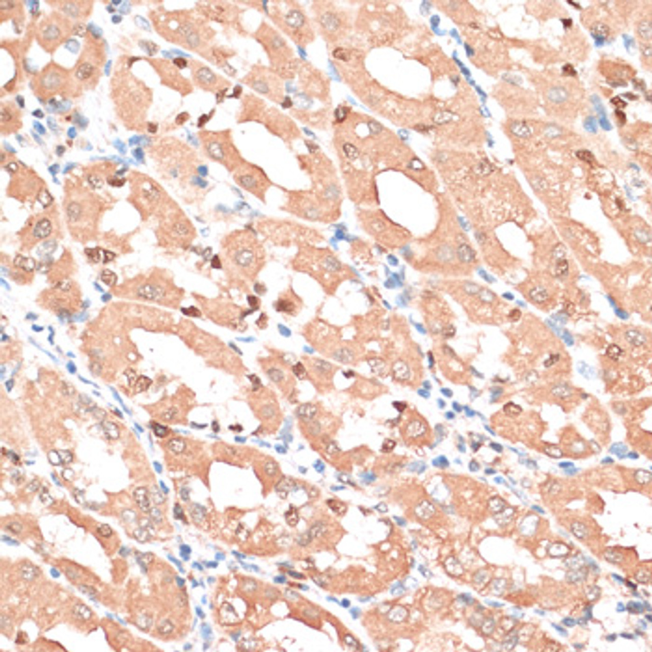 Immunohistochemistry of paraffin-embedded human stomach using HMGA1 antibody (16-565) at dilution of 1:100 (40x lens) .