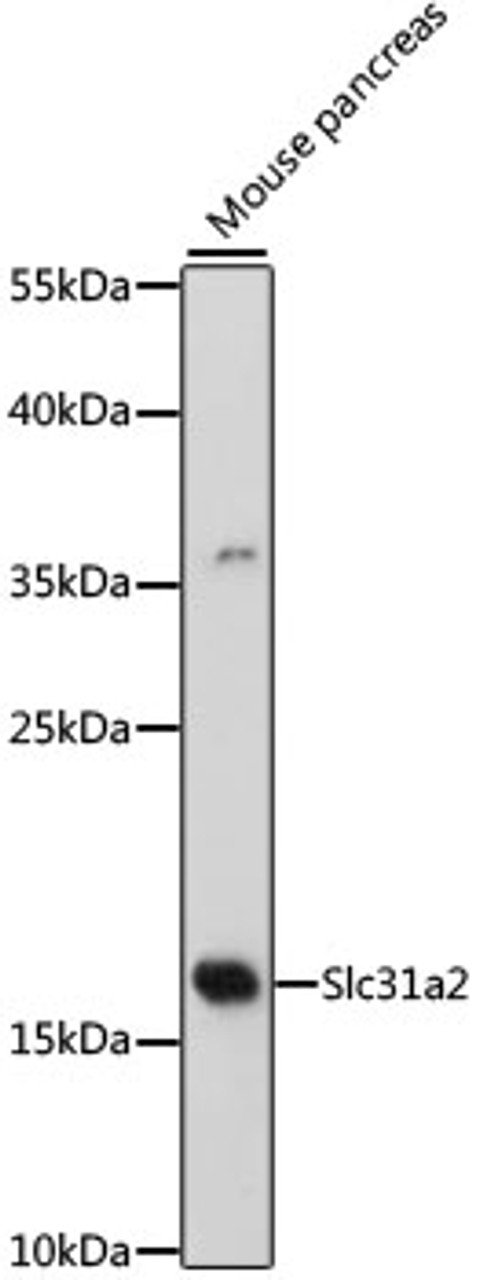 Western blot analysis of extracts of mouse pancreas, using Slc31a2 antibody (16-570) at 1:500 dilution.<br/>Secondary antibody: HRP Goat Anti-Rabbit IgG (H+L) at 1:10000 dilution.<br/>Lysates/proteins: 25ug per lane.<br/>Blocking buffer: 3% nonfat dry milk in TBST.<br/>Detection: ECL Basic Kit.<br/>Exposure time: 90s.