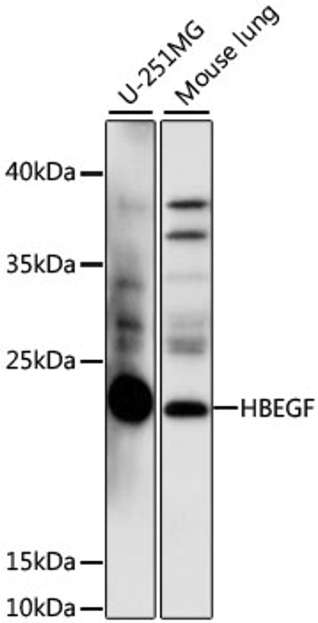 Western blot analysis of extracts of various cell lines, using HBEGF antibody (16-572) at 1:1000 dilution.<br/>Secondary antibody: HRP Goat Anti-Rabbit IgG (H+L) at 1:10000 dilution.<br/>Lysates/proteins: 25ug per lane.<br/>Blocking buffer: 3% nonfat dry milk in TBST.<br/>Detection: ECL Basic Kit.<br/>Exposure time: 90s.
