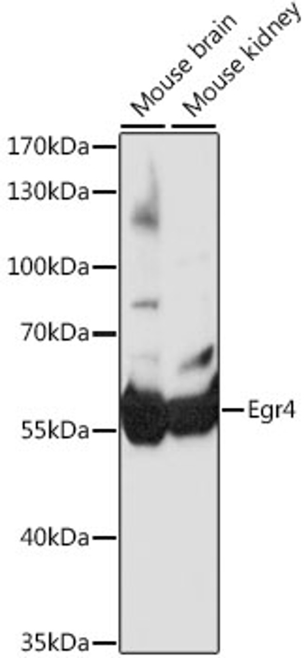 Western blot analysis of extracts of various cell lines, using Egr4 antibody (16-575) at 1:1000 dilution.<br/>Secondary antibody: HRP Goat Anti-Rabbit IgG (H+L) at 1:10000 dilution.<br/>Lysates/proteins: 25ug per lane.<br/>Blocking buffer: 3% nonfat dry milk in TBST.<br/>Detection: ECL Basic Kit.<br/>Exposure time: 30s.