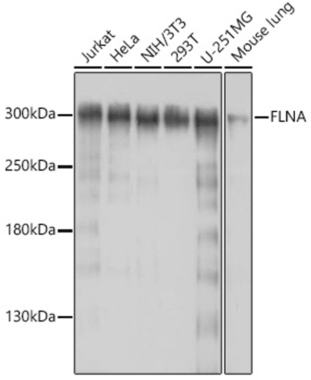 Western blot analysis of extracts of various cell lines, using FLNA antibody (16-580) at 1:1000 dilution.<br/>Secondary antibody: HRP Goat Anti-Rabbit IgG (H+L) at 1:10000 dilution.<br/>Lysates/proteins: 25ug per lane.<br/>Blocking buffer: 3% nonfat dry milk in TBST.<br/>Detection: ECL Basic Kit.<br/>Exposure time: 30s.