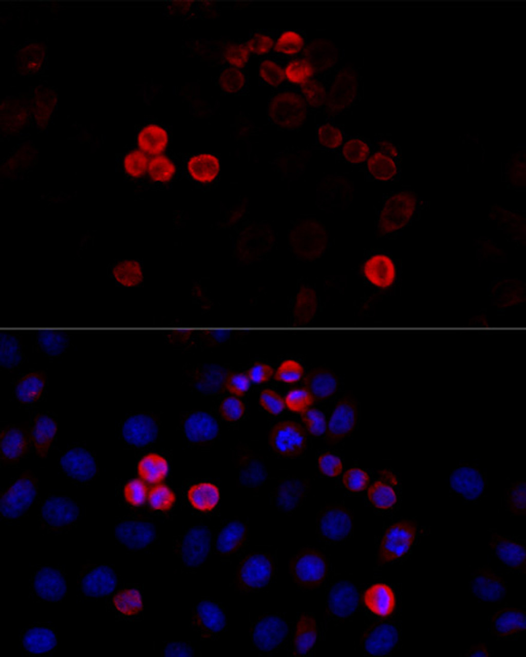 Immunofluorescence analysis of HeLa cells using FLNA antibody (16-580) at dilution of 1:100 (40x lens) . Blue: DAPI for nuclear staining.
