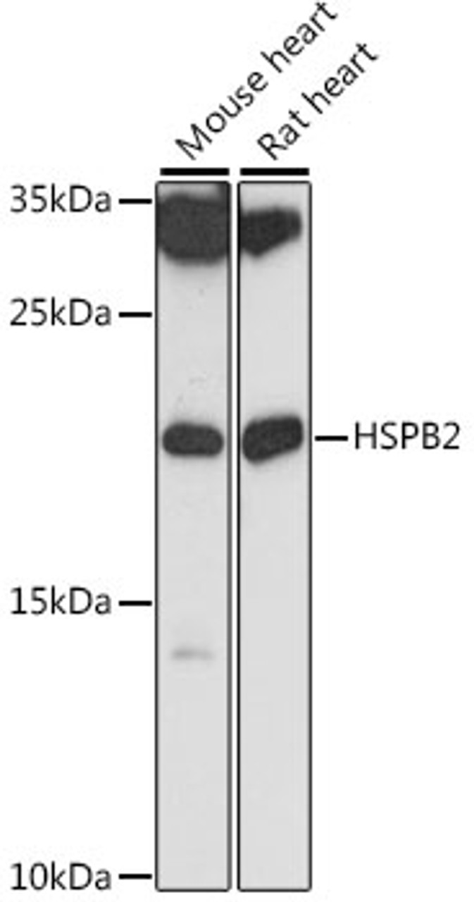 Western blot analysis of extracts of various cell lines, using HSPB2 antibody (16-581) at 1:1000 dilution.<br/>Secondary antibody: HRP Goat Anti-Rabbit IgG (H+L) at 1:10000 dilution.<br/>Lysates/proteins: 25ug per lane.<br/>Blocking buffer: 3% nonfat dry milk in TBST.<br/>Detection: ECL Basic Kit.<br/>Exposure time: 90s.