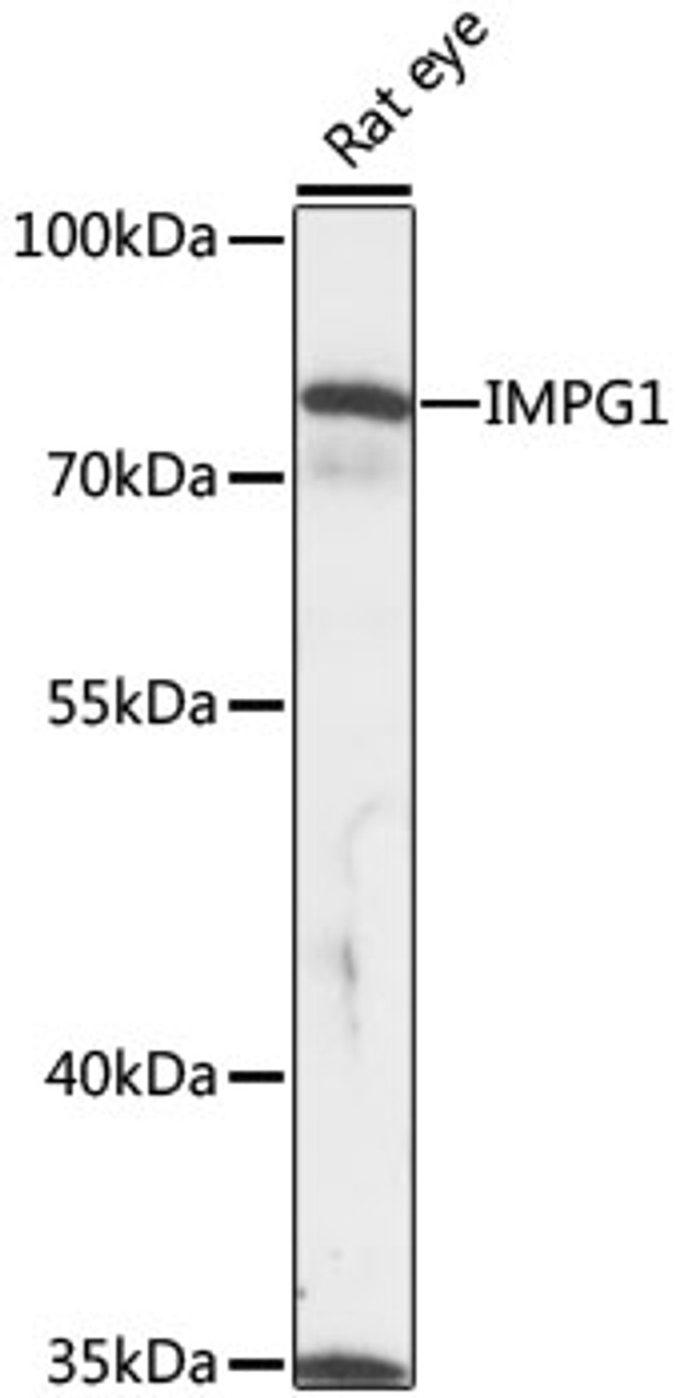 Western blot analysis of extracts of rat eye, using IMPG1 antibody (16-583) at 1:1000 dilution.<br/>Secondary antibody: HRP Goat Anti-Rabbit IgG (H+L) at 1:10000 dilution.<br/>Lysates/proteins: 25ug per lane.<br/>Blocking buffer: 3% nonfat dry milk in TBST.<br/>Detection: ECL Basic Kit.<br/>Exposure time: 10s.
