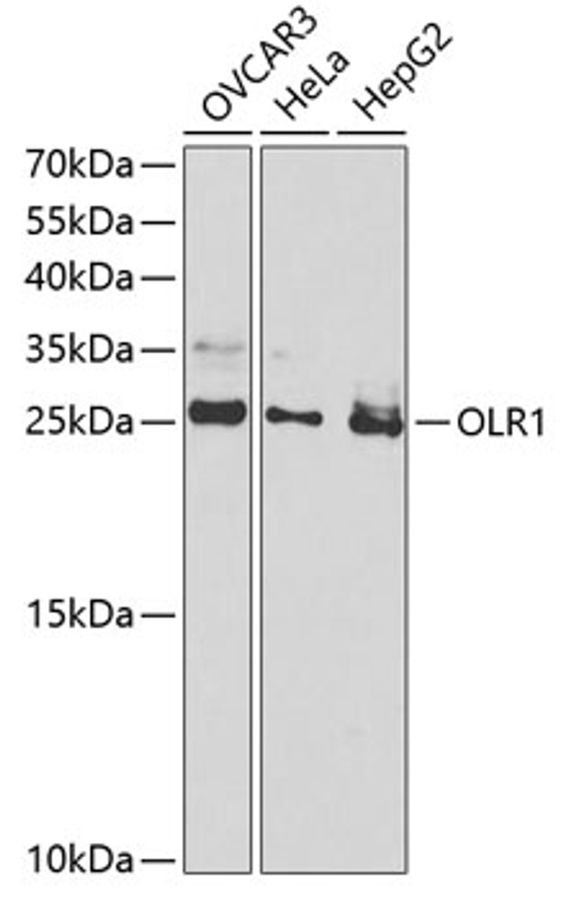 Western blot analysis of extracts of various cell lines, using OLR1 antibody (16-584) at 1:1000 dilution.<br/>Secondary antibody: HRP Goat Anti-Rabbit IgG (H+L) at 1:10000 dilution.<br/>Lysates/proteins: 25ug per lane.<br/>Blocking buffer: 3% nonfat dry milk in TBST.