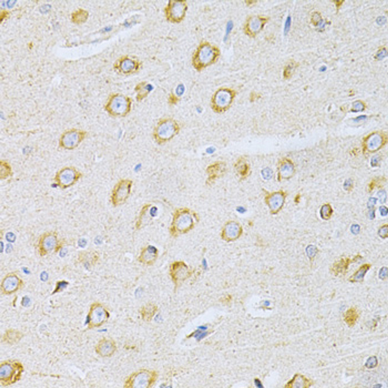 Immunohistochemistry of paraffin-embedded rat brain using OLR1 Antibody (16-584) at dilution of 1:200 (40x lens) .