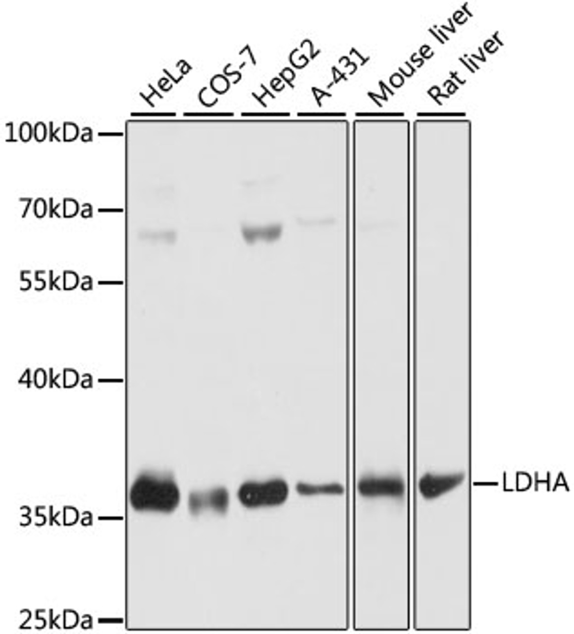 Western blot analysis of extracts of various cell lines, using LDHA antibody (16-586) at 1:1000 dilution.<br/>Secondary antibody: HRP Goat Anti-Rabbit IgG (H+L) at 1:10000 dilution.<br/>Lysates/proteins: 25ug per lane.<br/>Blocking buffer: 3% nonfat dry milk in TBST.<br/>Detection: ECL Basic Kit.<br/>Exposure time: 1s.