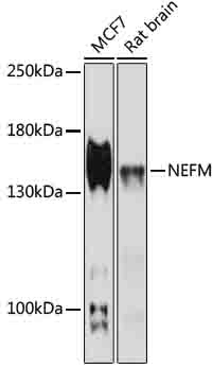 Western blot analysis of extracts of various cell lines, using NEFM antibody (16-591) at 1:1000 dilution.<br/>Secondary antibody: HRP Goat Anti-Rabbit IgG (H+L) at 1:10000 dilution.<br/>Lysates/proteins: 25ug per lane.<br/>Blocking buffer: 3% nonfat dry milk in TBST.<br/>Detection: ECL Basic Kit.<br/>Exposure time: 90s.