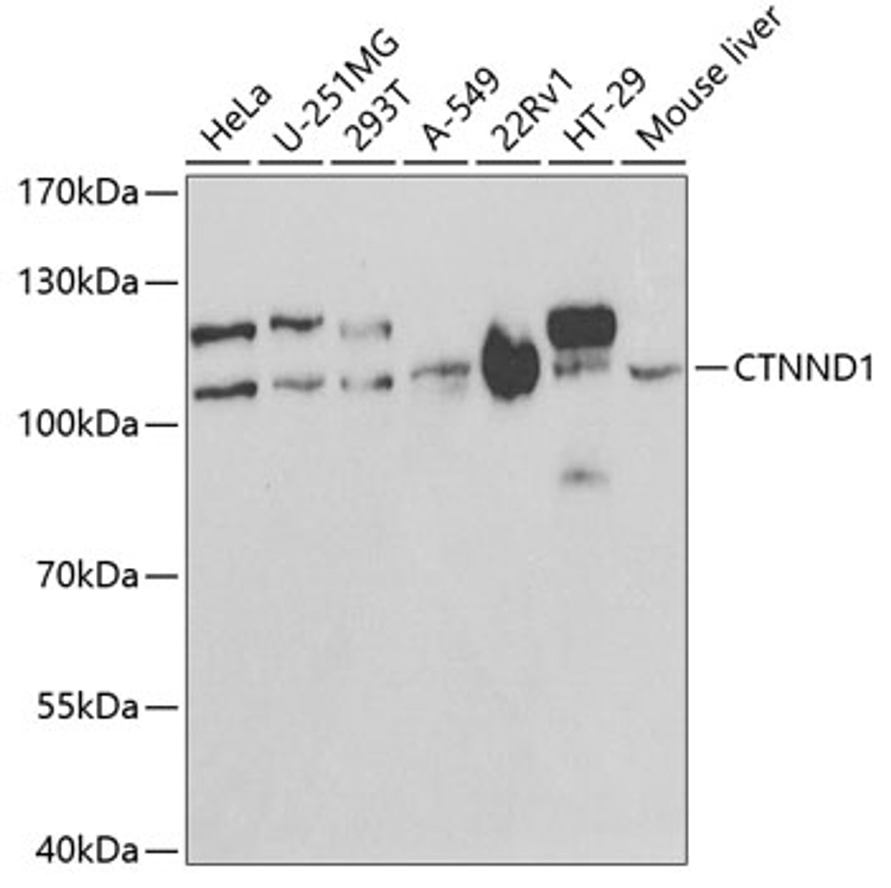 Western blot analysis of extracts of various cell lines, using CTNND1 antibody (16-592) at 1:1000 dilution.<br/>Secondary antibody: HRP Goat Anti-Rabbit IgG (H+L) at 1:10000 dilution.<br/>Lysates/proteins: 25ug per lane.<br/>Blocking buffer: 3% nonfat dry milk in TBST.