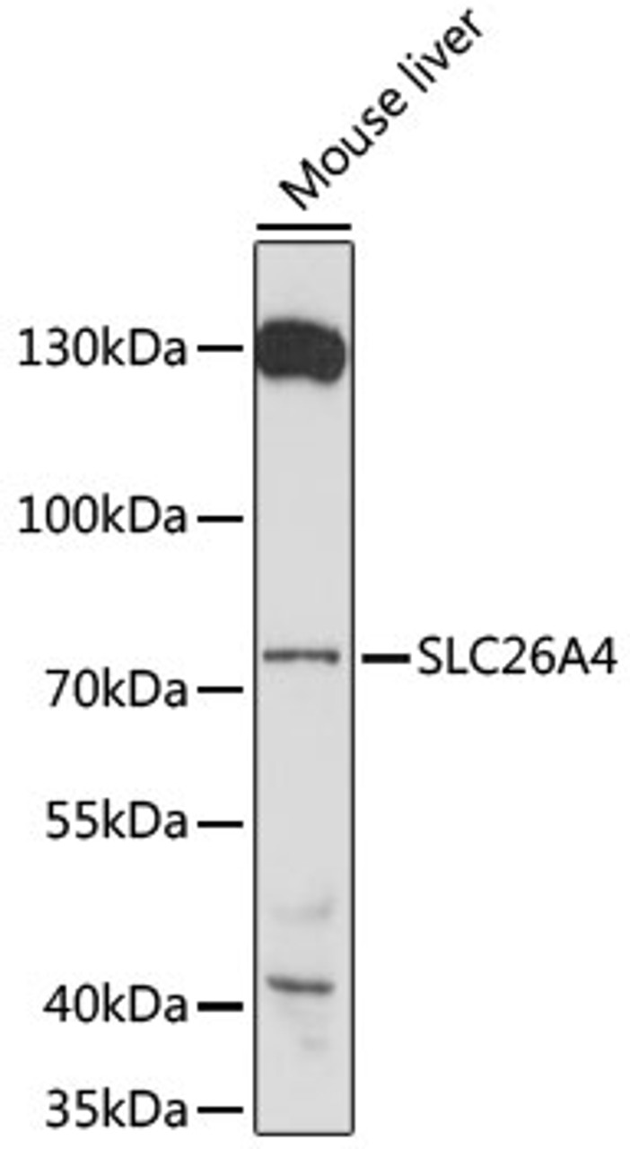 Western blot analysis of extracts of mouse liver, using SLC26A4 antibody (16-594) at 1:1000 dilution.<br/>Secondary antibody: HRP Goat Anti-Rabbit IgG (H+L) at 1:10000 dilution.<br/>Lysates/proteins: 25ug per lane.<br/>Blocking buffer: 3% nonfat dry milk in TBST.<br/>Detection: ECL Basic Kit.<br/>Exposure time: 3 min.