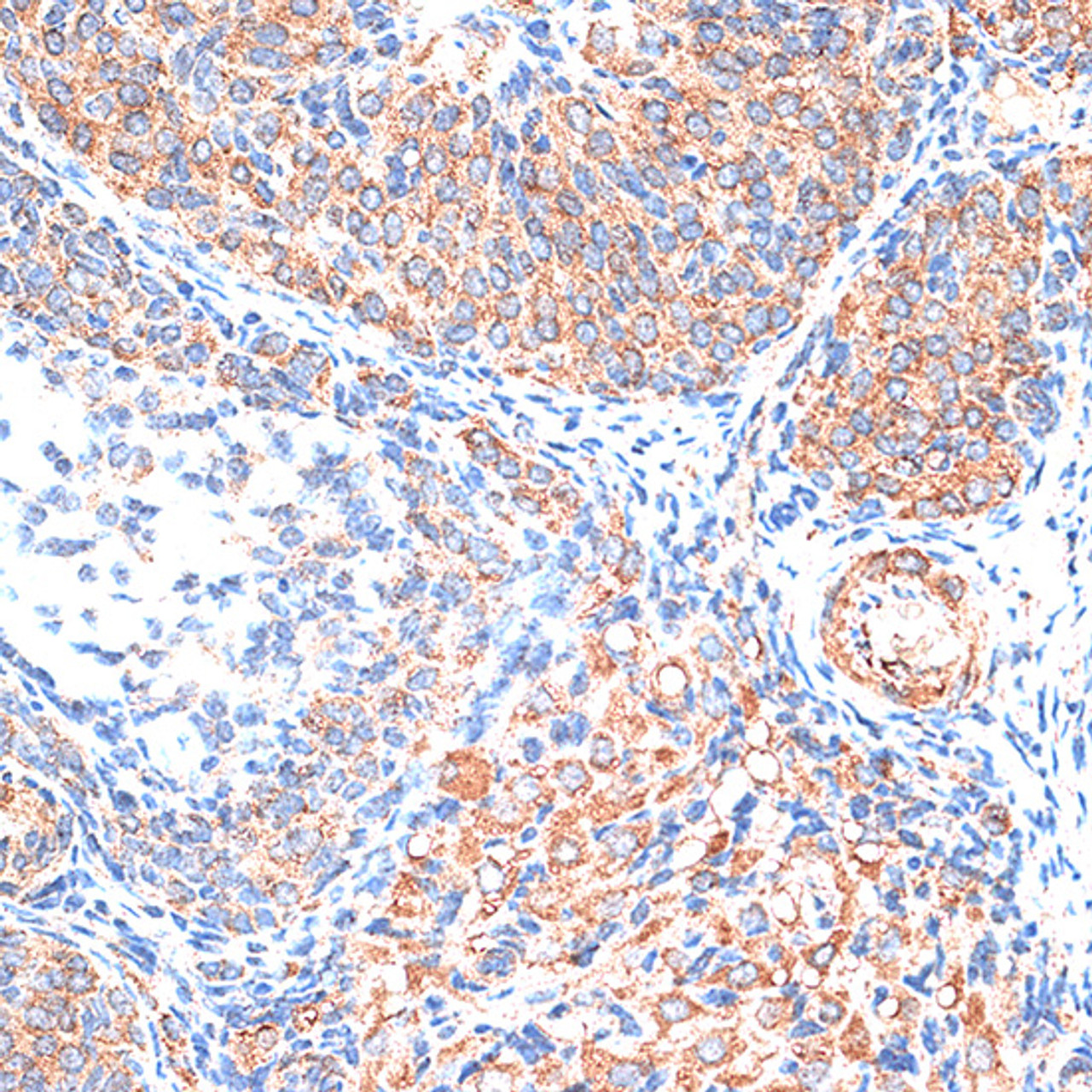 Immunohistochemistry of paraffin-embedded Rat ovary using TIMP2 antibody (16-606) at dilution of 1:100 (40x lens) .