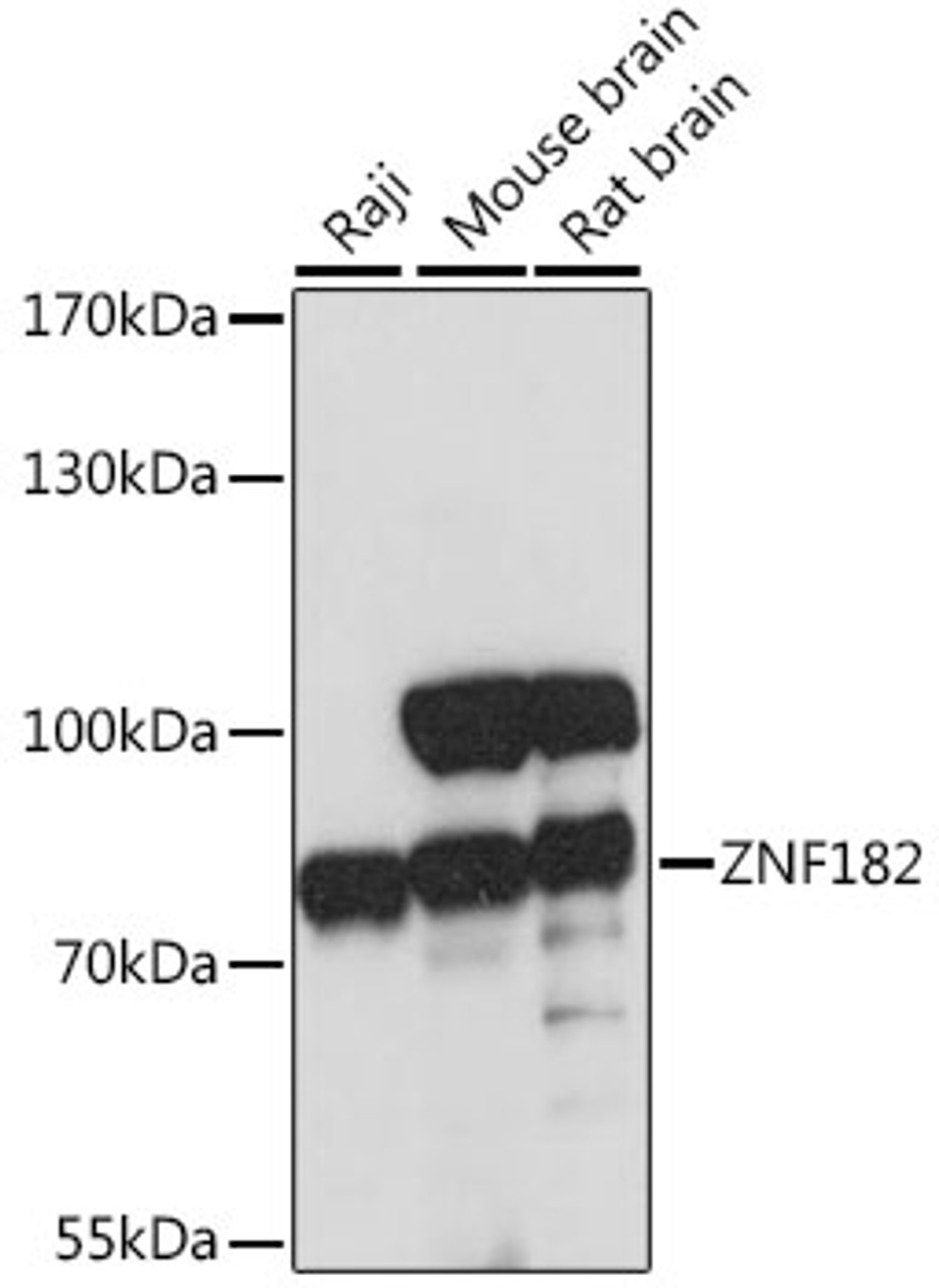 Western blot analysis of extracts of various cell lines, using ZNF182 antibody (16-608) at 1:1000 dilution.<br/>Secondary antibody: HRP Goat Anti-Rabbit IgG (H+L) at 1:10000 dilution.<br/>Lysates/proteins: 25ug per lane.<br/>Blocking buffer: 3% nonfat dry milk in TBST.<br/>Detection: ECL Basic Kit.<br/>Exposure time: 30s.
