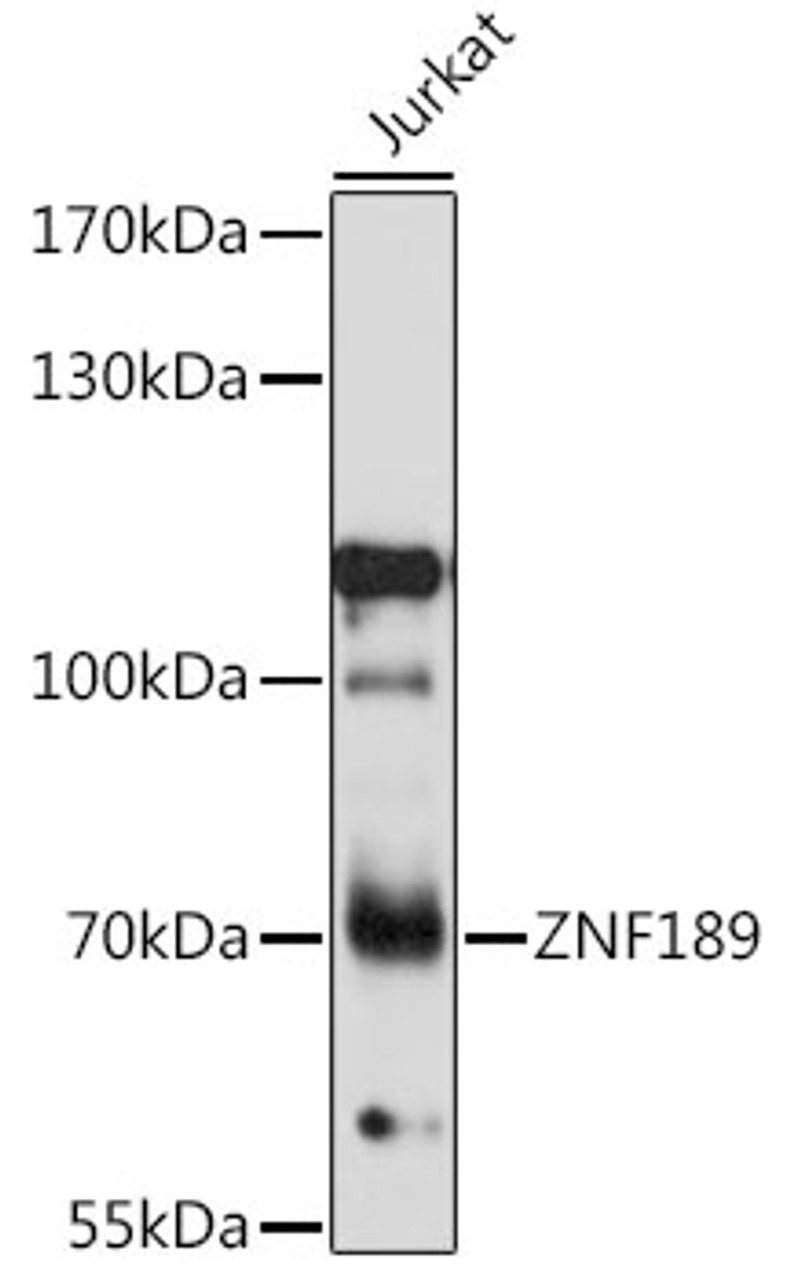 Western blot analysis of extracts of Jurkat cells, using ZNF189 antibody (16-609) at 1:1000 dilution.<br/>Secondary antibody: HRP Goat Anti-Rabbit IgG (H+L) at 1:10000 dilution.<br/>Lysates/proteins: 25ug per lane.<br/>Blocking buffer: 3% nonfat dry milk in TBST.<br/>Detection: ECL Basic Kit.<br/>Exposure time: 10s.