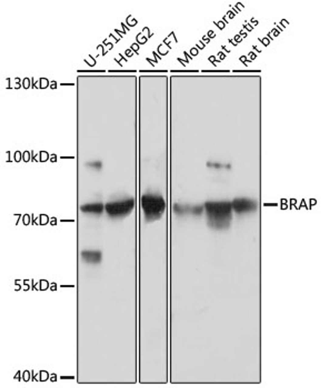 Western blot analysis of extracts of various cell lines, using BRAP antibody (16-611) at 1:3000 dilution.<br/>Secondary antibody: HRP Goat Anti-Rabbit IgG (H+L) at 1:10000 dilution.<br/>Lysates/proteins: 25ug per lane.<br/>Blocking buffer: 3% nonfat dry milk in TBST.<br/>Detection: ECL Basic Kit.<br/>Exposure time: 10s.