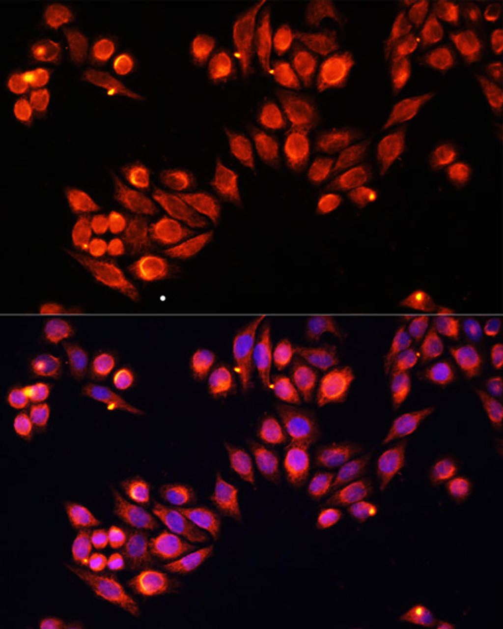 Immunofluorescence analysis of HeLa cells using Heparanase 1 antibody (16-627) at dilution of 1:100. Blue: DAPI for nuclear staining.