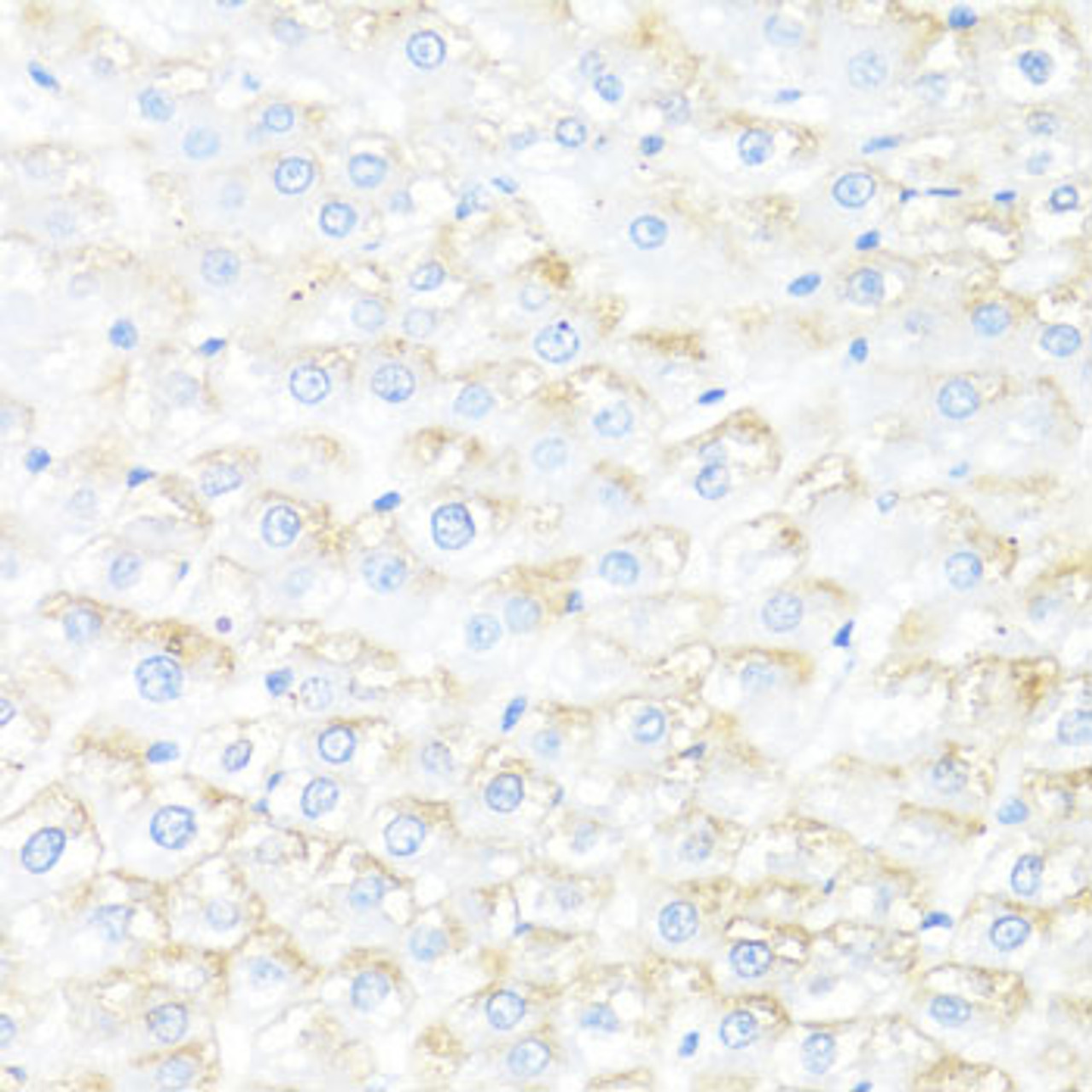 Immunohistochemistry of paraffin-embedded rat liver using IL7 antibody (16-631) at dilution of 1:100 (40x lens) .