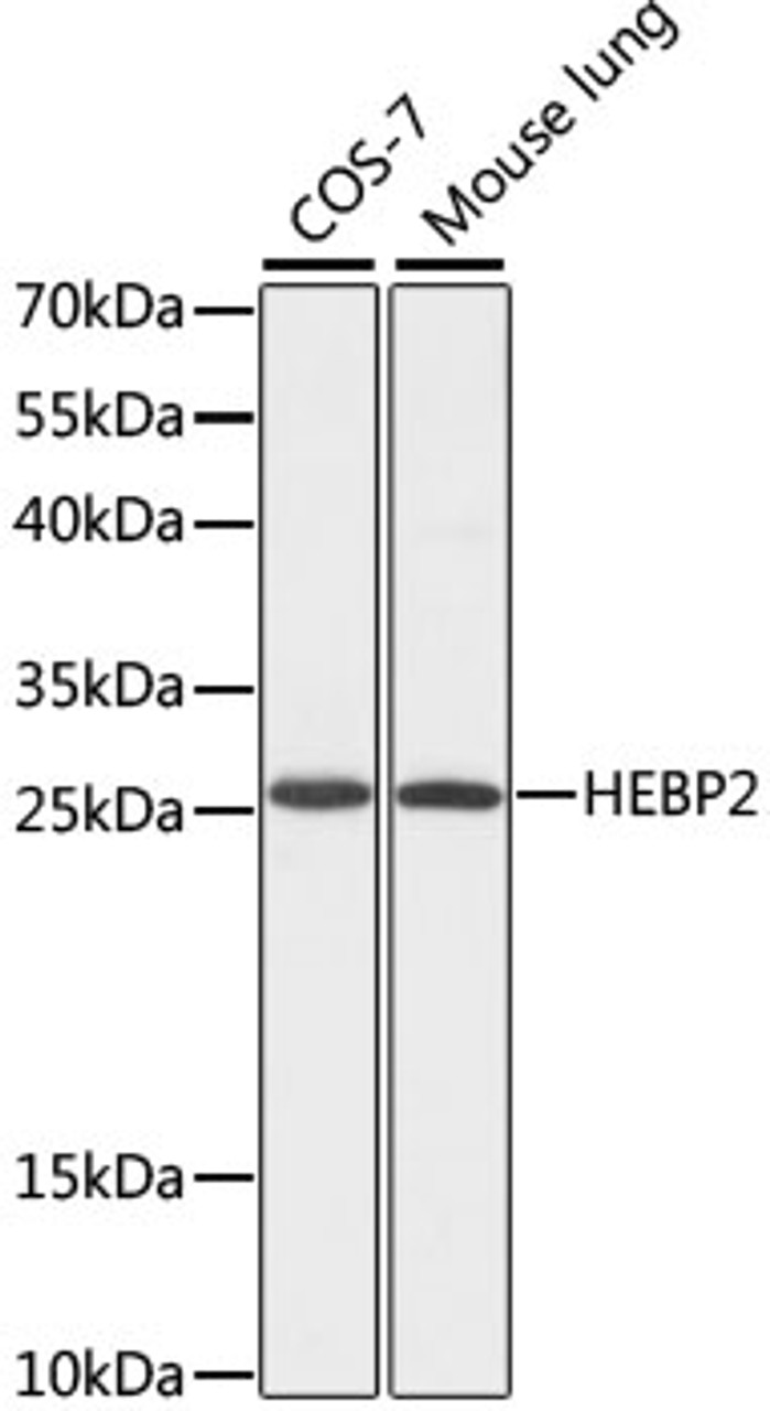 Western blot analysis of extracts of various cell lines, using HEBP2 antibody (16-633) at 1:1000 dilution.<br/>Secondary antibody: HRP Goat Anti-Rabbit IgG (H+L) at 1:10000 dilution.<br/>Lysates/proteins: 25ug per lane.<br/>Blocking buffer: 3% nonfat dry milk in TBST.<br/>Detection: ECL Basic Kit.<br/>Exposure time: 30s.