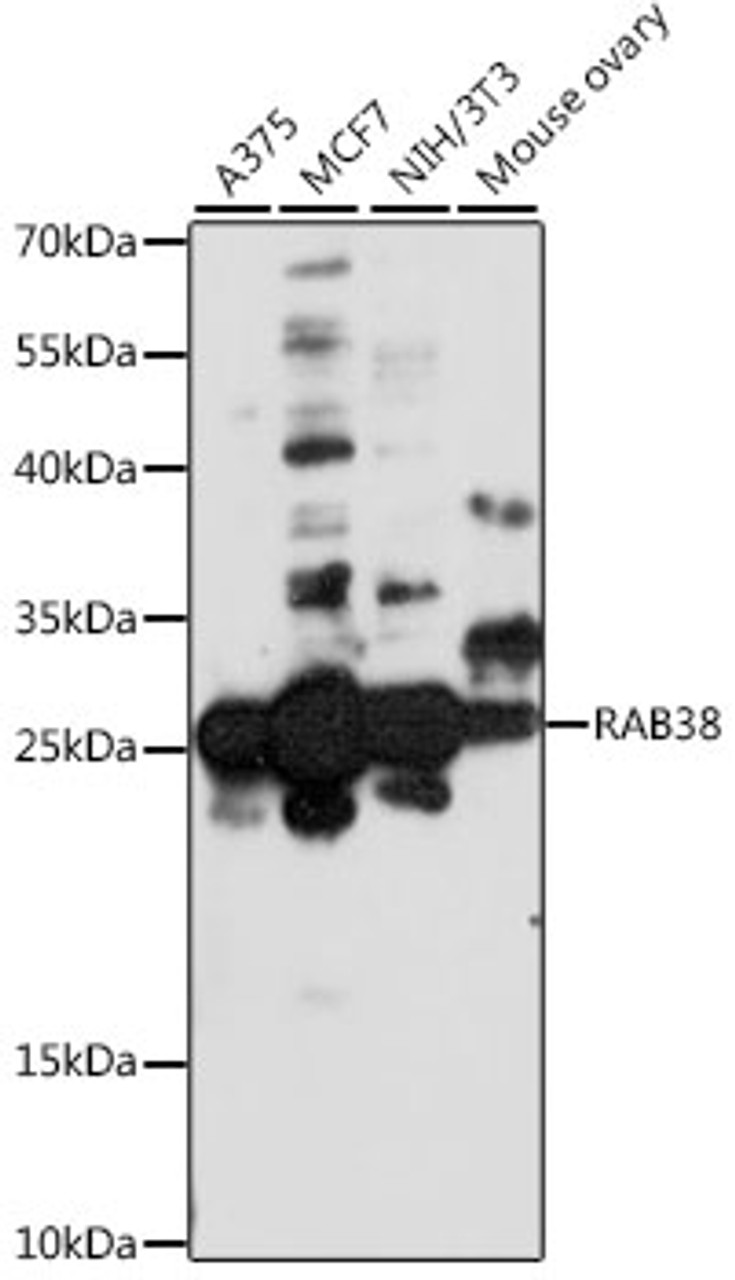 Western blot analysis of extracts of various cell lines, using RAB38 antibody (16-634) at 1:1000 dilution.<br/>Secondary antibody: HRP Goat Anti-Rabbit IgG (H+L) at 1:10000 dilution.<br/>Lysates/proteins: 25ug per lane.<br/>Blocking buffer: 3% nonfat dry milk in TBST.<br/>Detection: ECL Basic Kit.<br/>Exposure time: 90s.
