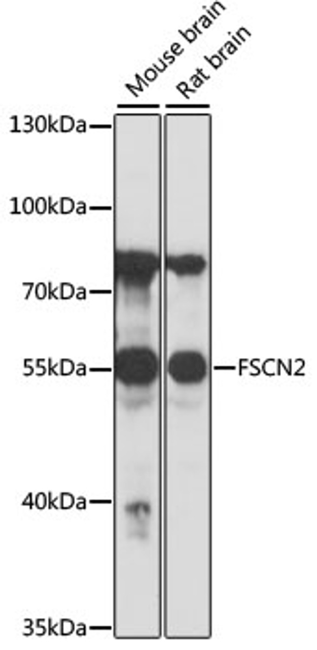 Western blot analysis of extracts of various cell lines, using FSCN2 antibody (16-636) at 1:1000 dilution.<br/>Secondary antibody: HRP Goat Anti-Rabbit IgG (H+L) at 1:10000 dilution.<br/>Lysates/proteins: 25ug per lane.<br/>Blocking buffer: 3% nonfat dry milk in TBST.<br/>Detection: ECL Basic Kit.<br/>Exposure time: 3s.