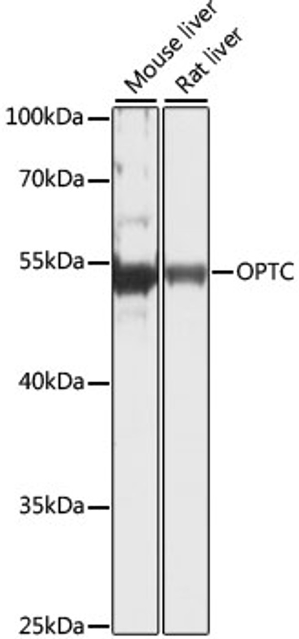 Western blot analysis of extracts of various cell lines, using OPTC antibody (16-637) at 1:1000 dilution.<br/>Secondary antibody: HRP Goat Anti-Rabbit IgG (H+L) at 1:10000 dilution.<br/>Lysates/proteins: 25ug per lane.<br/>Blocking buffer: 3% nonfat dry milk in TBST.<br/>Detection: ECL Basic Kit.<br/>Exposure time: 5s.