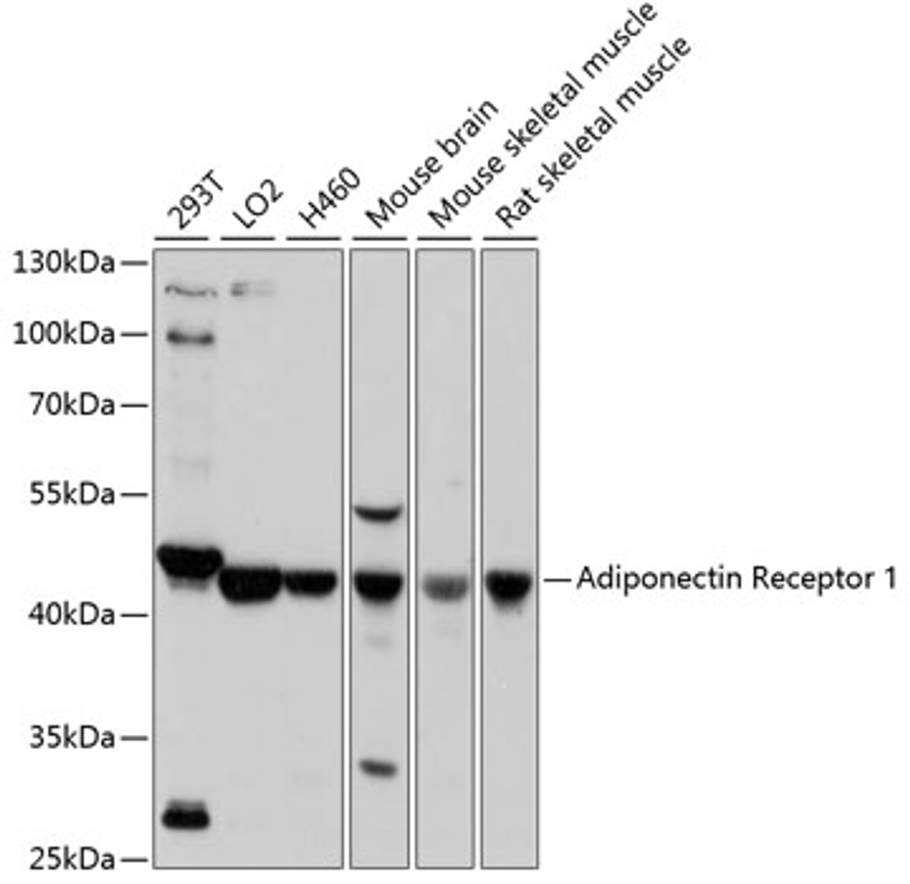 Western blot analysis of extracts of various cell lines, using Adiponectin Receptor 1 antibody (16-643) at 1:1000 dilution.<br/>Secondary antibody: HRP Goat Anti-Rabbit IgG (H+L) at 1:10000 dilution.<br/>Lysates/proteins: 25ug per lane.<br/>Blocking buffer: 3% nonfat dry milk in TBST.<br/>Detection: ECL Basic Kit.<br/>Exposure time: 5s.