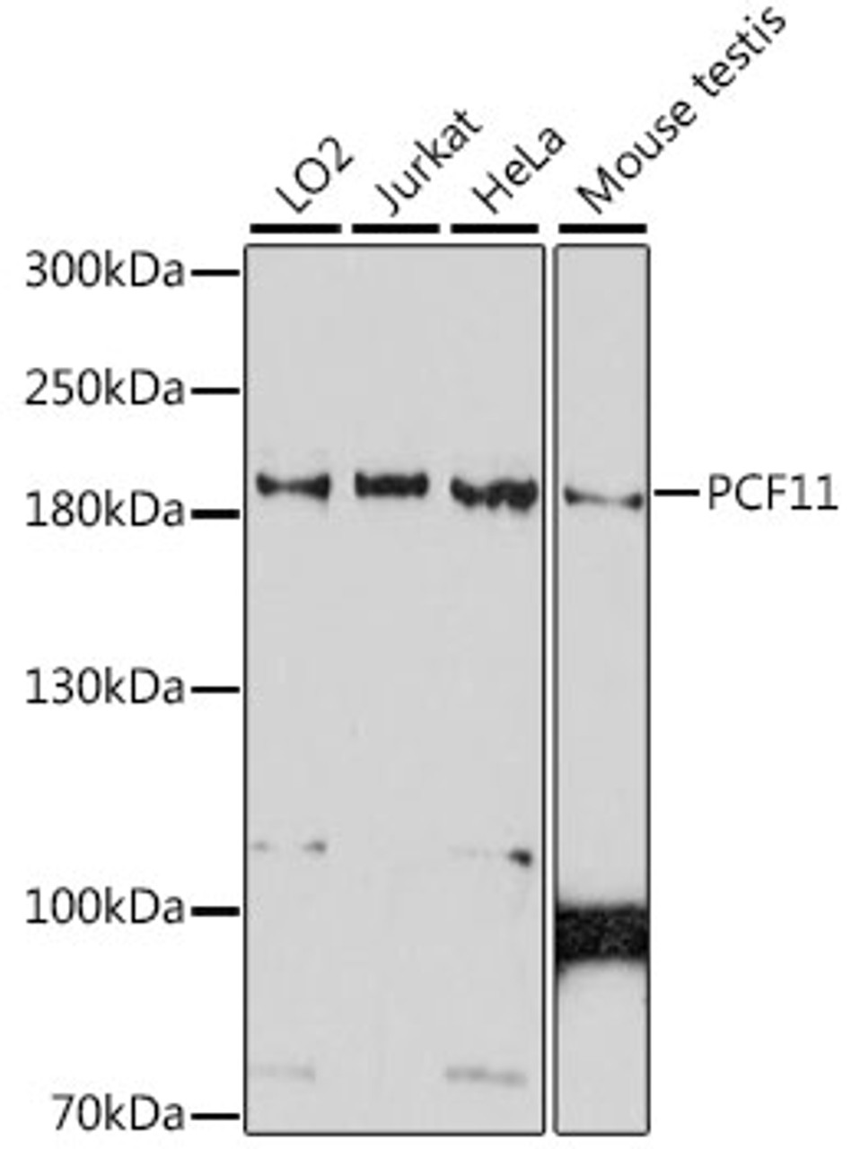 Western blot analysis of extracts of various cell lines, using PCF11 antibody (16-646) at 1:1000 dilution.<br/>Secondary antibody: HRP Goat Anti-Rabbit IgG (H+L) at 1:10000 dilution.<br/>Lysates/proteins: 25ug per lane.<br/>Blocking buffer: 3% nonfat dry milk in TBST.<br/>Detection: ECL Basic Kit.<br/>Exposure time: 90s.