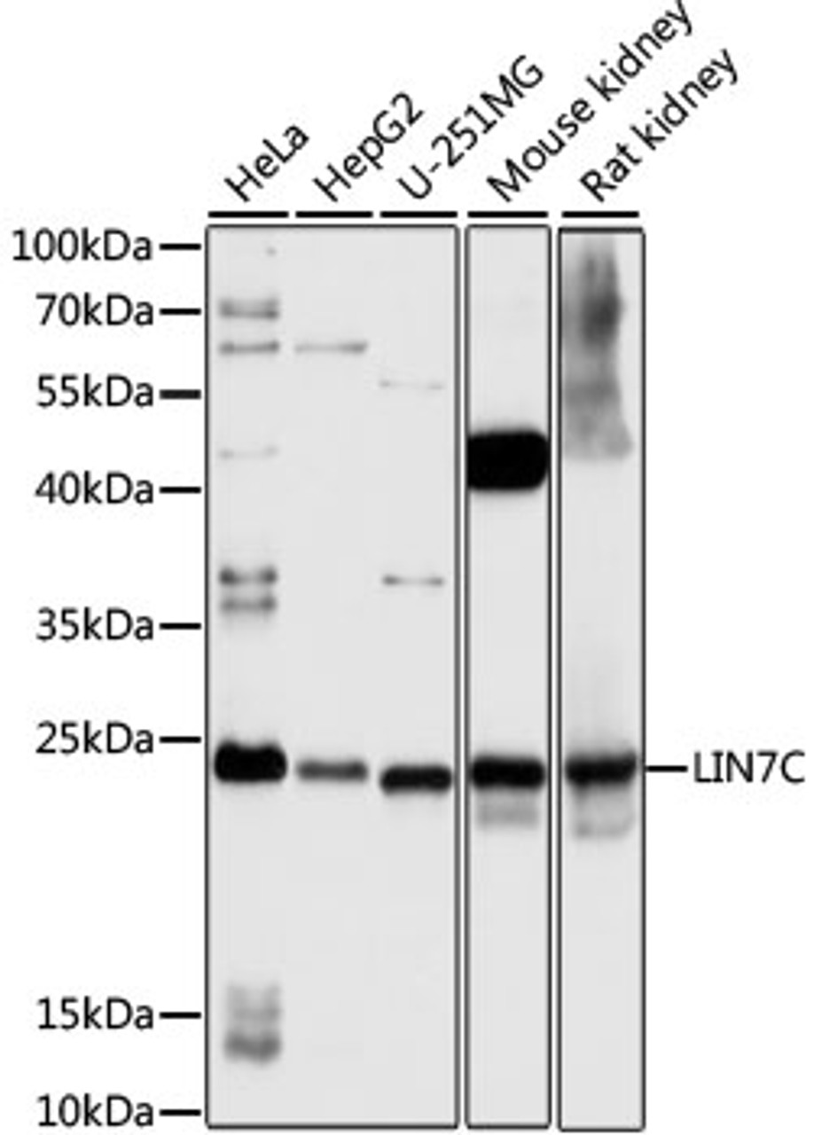 Western blot analysis of extracts of various cell lines, using LIN7C antibody (16-650) at 1:1000 dilution.<br/>Secondary antibody: HRP Goat Anti-Rabbit IgG (H+L) at 1:10000 dilution.<br/>Lysates/proteins: 25ug per lane.<br/>Blocking buffer: 3% nonfat dry milk in TBST.<br/>Detection: ECL Basic Kit.<br/>Exposure time: 3s.