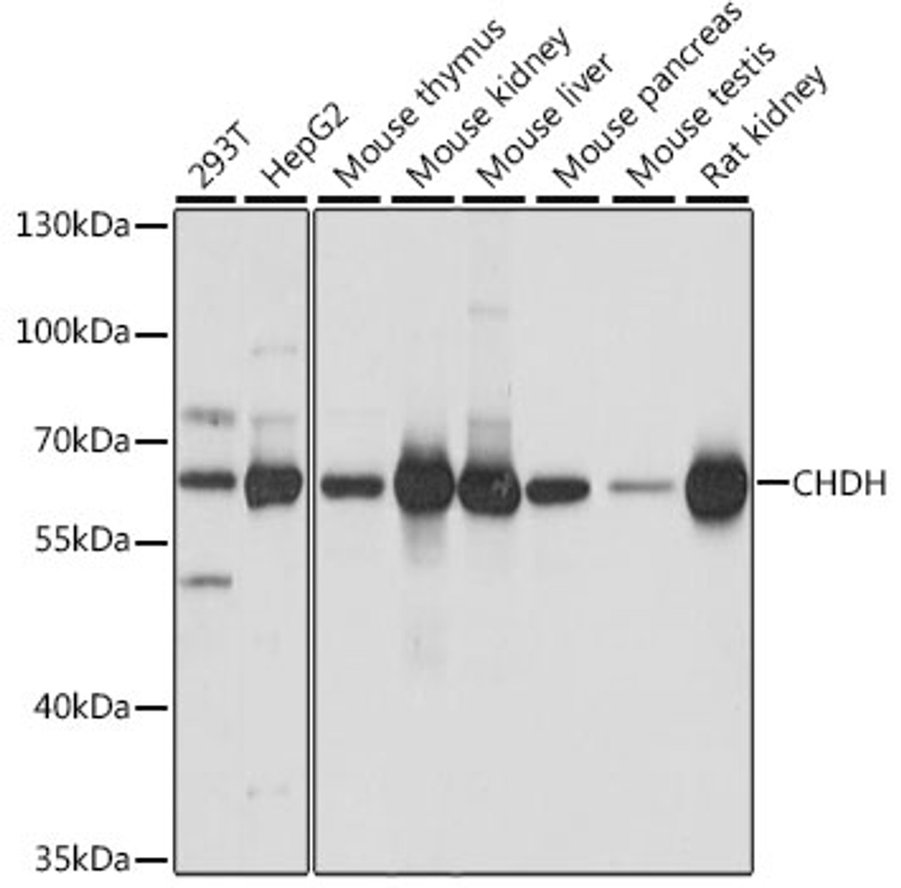Western blot analysis of extracts of various cell lines, using CHDH antibody (16-651) at 1:1000 dilution.<br/>Secondary antibody: HRP Goat Anti-Rabbit IgG (H+L) at 1:10000 dilution.<br/>Lysates/proteins: 25ug per lane.<br/>Blocking buffer: 3% nonfat dry milk in TBST.<br/>Detection: ECL Basic Kit.<br/>Exposure time: 3s.