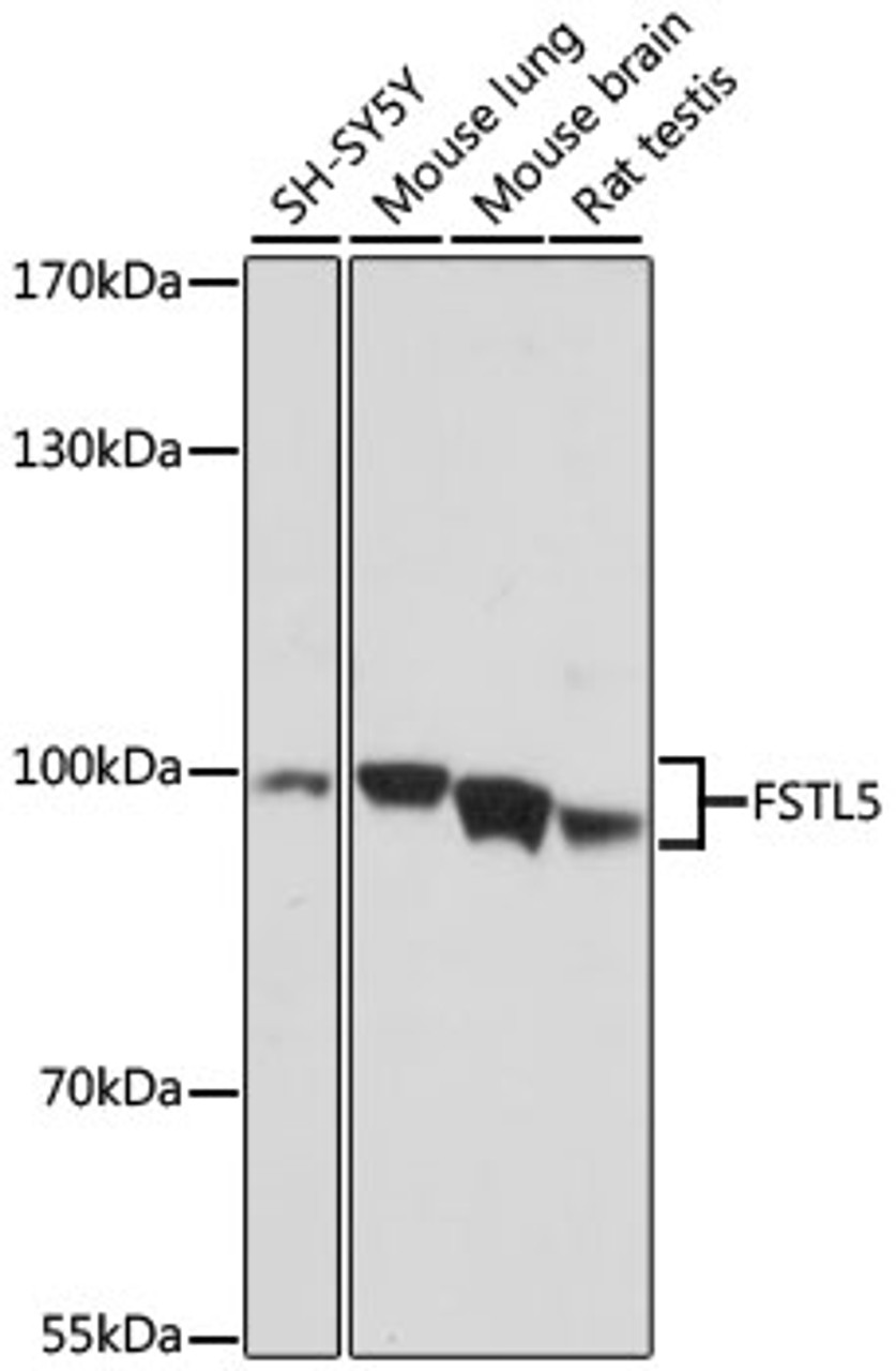 Western blot analysis of extracts of various cell lines, using FSTL5 antibody (16-653) at 1:1000 dilution.<br/>Secondary antibody: HRP Goat Anti-Rabbit IgG (H+L) at 1:10000 dilution.<br/>Lysates/proteins: 25ug per lane.<br/>Blocking buffer: 3% nonfat dry milk in TBST.<br/>Detection: ECL Basic Kit.<br/>Exposure time: 5s.