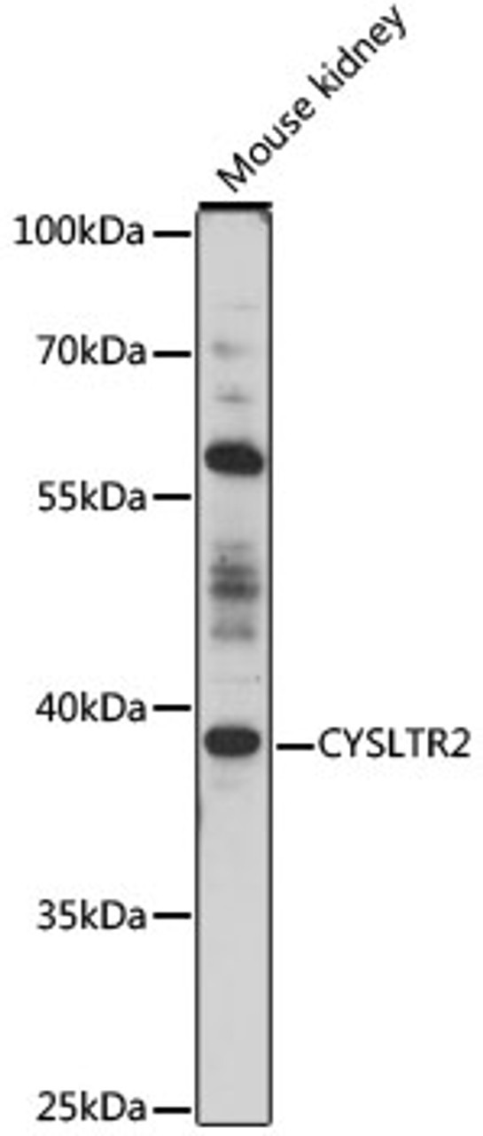 Western blot analysis of extracts of mouse kidney, using CYSLTR2 antibody (16-655) at 1:1000 dilution.<br/>Secondary antibody: HRP Goat Anti-Rabbit IgG (H+L) at 1:10000 dilution.<br/>Lysates/proteins: 25ug per lane.<br/>Blocking buffer: 3% nonfat dry milk in TBST.<br/>Detection: ECL Basic Kit.<br/>Exposure time: 10s.