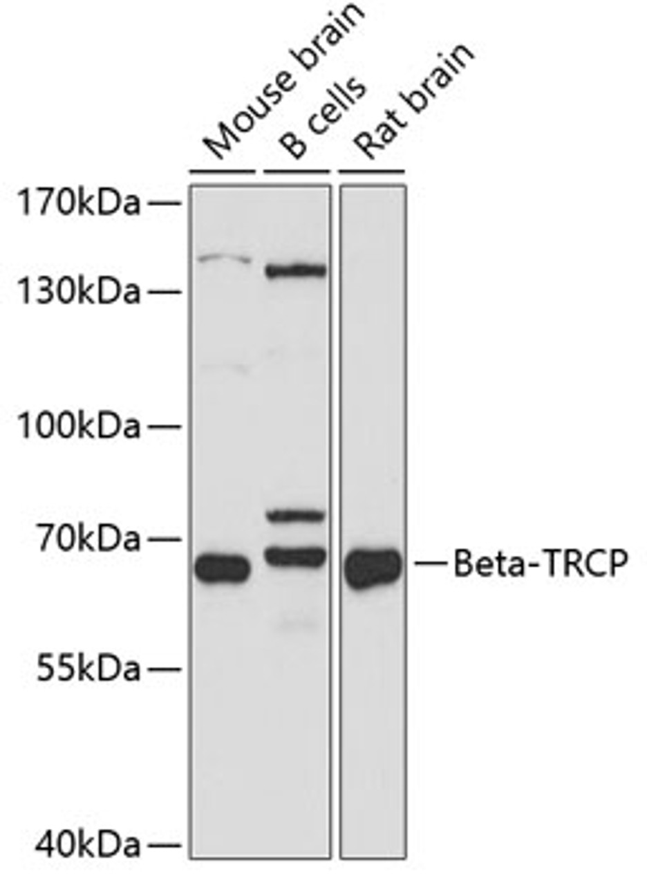 Western blot analysis of extracts of various cell lines, using Beta-TRCP antibody (16-657) at 1:1000 dilution.<br/>Secondary antibody: HRP Goat Anti-Rabbit IgG (H+L) at 1:10000 dilution.<br/>Lysates/proteins: 25ug per lane.<br/>Blocking buffer: 3% nonfat dry milk in TBST.<br/>Detection: ECL Basic Kit.<br/>Exposure time: 60s.