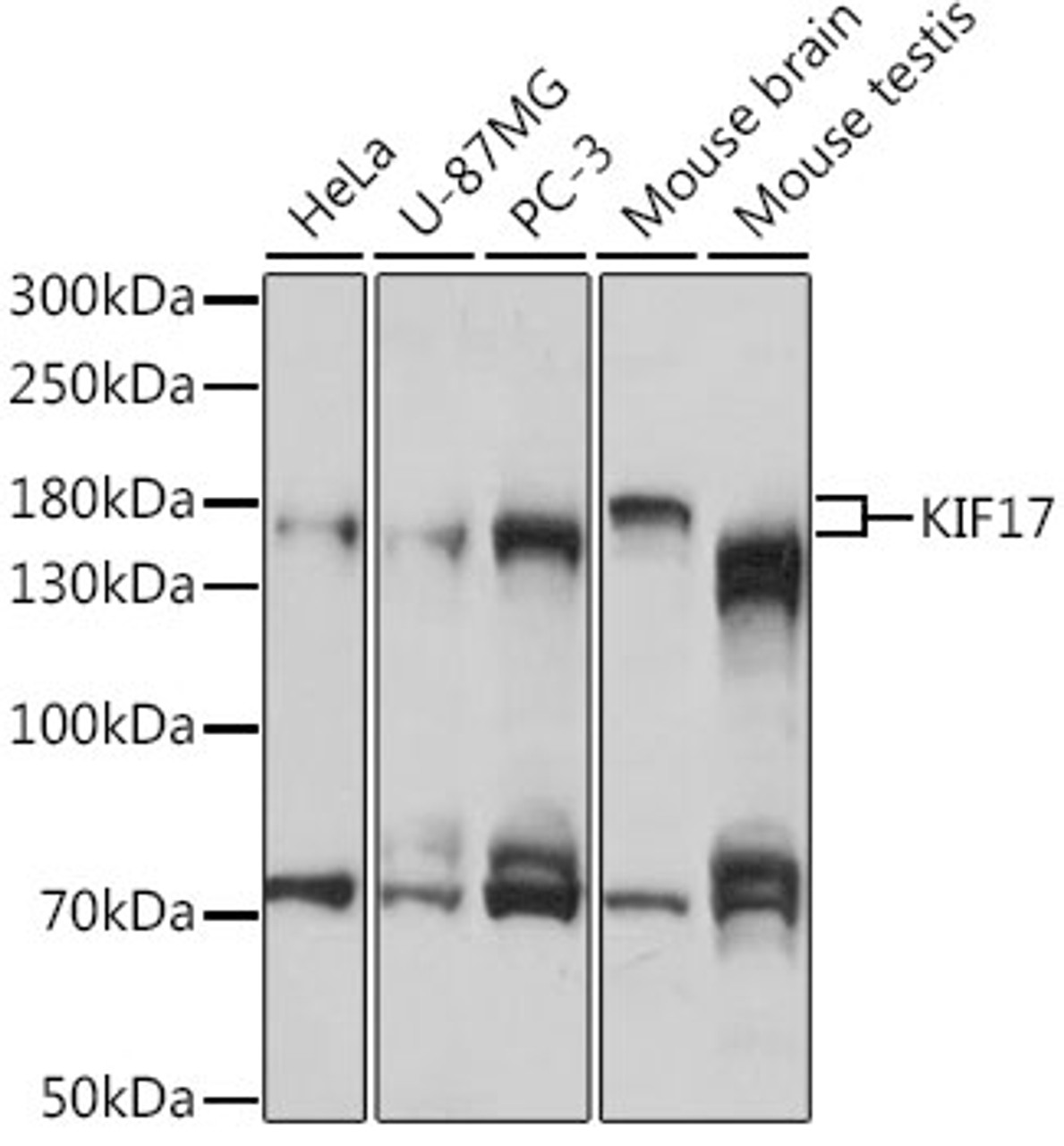 Western blot analysis of extracts of various cell lines, using KIF17 antibody (16-658) at 1:1000 dilution.<br/>Secondary antibody: HRP Goat Anti-Rabbit IgG (H+L) at 1:10000 dilution.<br/>Lysates/proteins: 25ug per lane.<br/>Blocking buffer: 3% nonfat dry milk in TBST.<br/>Detection: ECL Basic Kit.<br/>Exposure time: 30s.