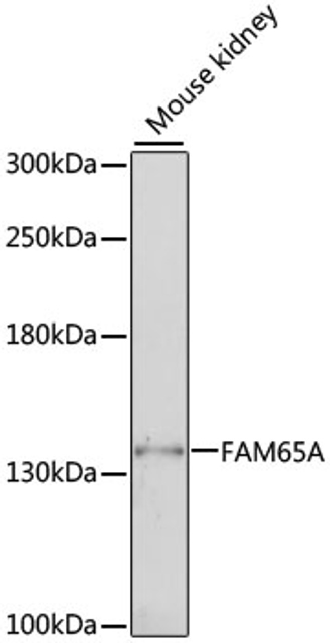 Western blot analysis of extracts of mouse kidney, using FAM65A antibody (16-660) at 1:1000 dilution.<br/>Secondary antibody: HRP Goat Anti-Rabbit IgG (H+L) at 1:10000 dilution.<br/>Lysates/proteins: 25ug per lane.<br/>Blocking buffer: 3% nonfat dry milk in TBST.<br/>Detection: ECL Basic Kit.<br/>Exposure time: 1s.