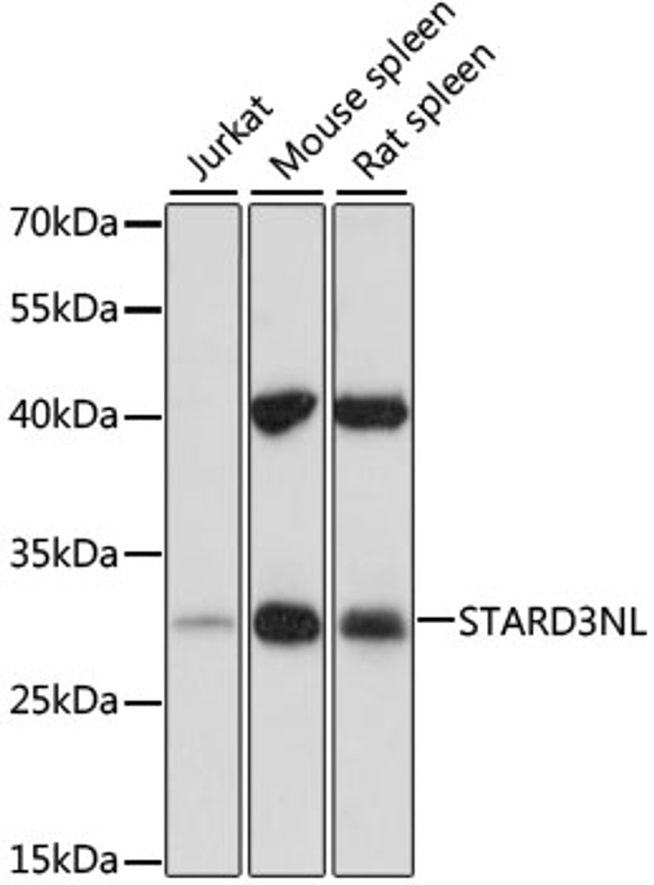 Western blot analysis of extracts of various cell lines, using STARD3NL antibody (16-662) at 1:1000 dilution.<br/>Secondary antibody: HRP Goat Anti-Rabbit IgG (H+L) at 1:10000 dilution.<br/>Lysates/proteins: 25ug per lane.<br/>Blocking buffer: 3% nonfat dry milk in TBST.<br/>Detection: ECL Basic Kit.<br/>Exposure time: 30s.