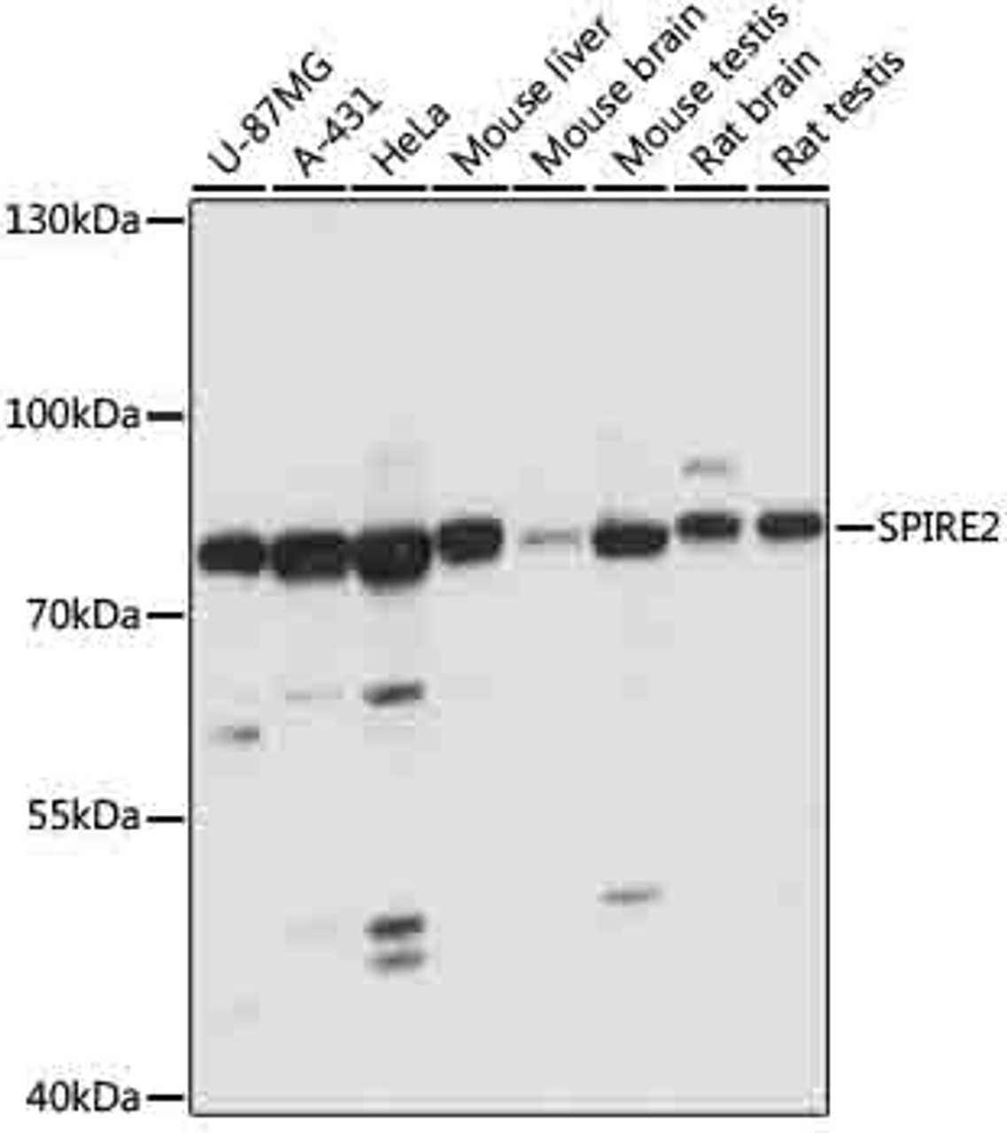 Western blot analysis of extracts of various cells, using SPIRE2 antibody (16-665) at 1:1000 dilution.<br/>Secondary antibody: HRP Goat Anti-Rabbit IgG (H+L) at 1:10000 dilution.<br/>Lysates/proteins: 25ug per lane.<br/>Blocking buffer: 3% nonfat dry milk in TBST.<br/>Detection: ECL Basic Kit.<br/>Exposure time: 1s.