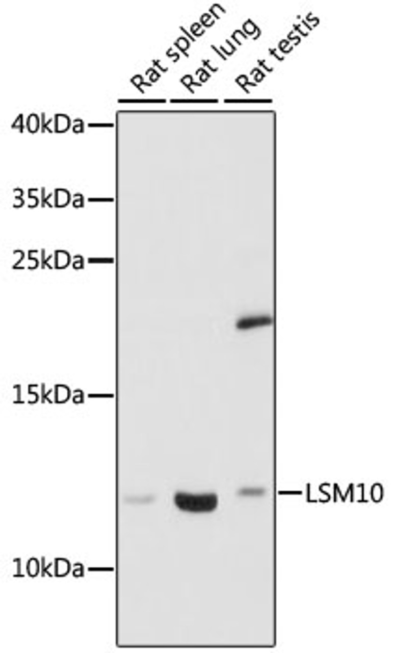 Western blot analysis of extracts of various cell lines, using LSM10 antibody (16-667) at 1:1000 dilution.<br/>Secondary antibody: HRP Goat Anti-Rabbit IgG (H+L) at 1:10000 dilution.<br/>Lysates/proteins: 25ug per lane.<br/>Blocking buffer: 3% nonfat dry milk in TBST.<br/>Detection: ECL Basic Kit.<br/>Exposure time: 30s.