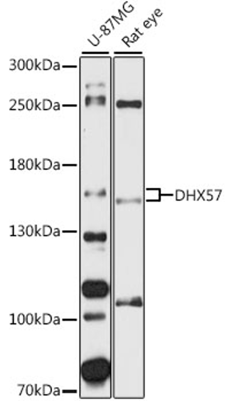 Western blot analysis of extracts of various cell lines, using DHX57 antibody (16-669) at 1:1000 dilution.<br/>Secondary antibody: HRP Goat Anti-Rabbit IgG (H+L) at 1:10000 dilution.<br/>Lysates/proteins: 25ug per lane.<br/>Blocking buffer: 3% nonfat dry milk in TBST.<br/>Detection: ECL Basic Kit.<br/>Exposure time: 90s.