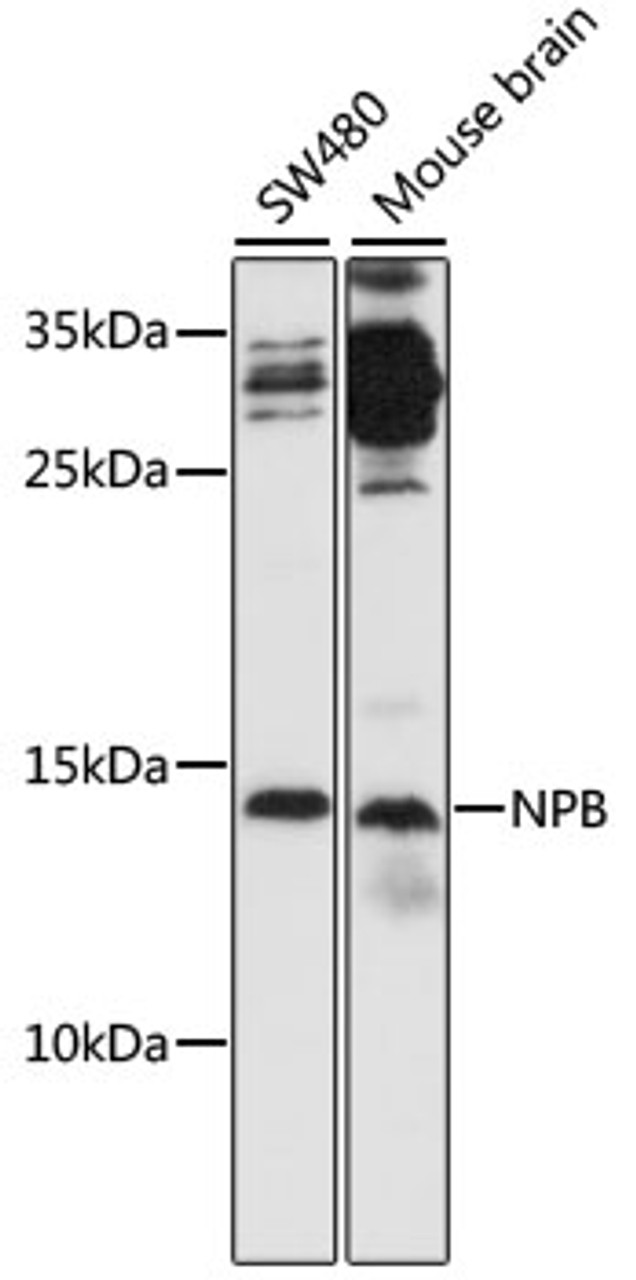 Western blot analysis of extracts of various cell lines, using NPB antibody (16-679) at 1:1000 dilution.<br/>Secondary antibody: HRP Goat Anti-Rabbit IgG (H+L) at 1:10000 dilution.<br/>Lysates/proteins: 25ug per lane.<br/>Blocking buffer: 3% nonfat dry milk in TBST.<br/>Detection: ECL Basic Kit.<br/>Exposure time: 90s.