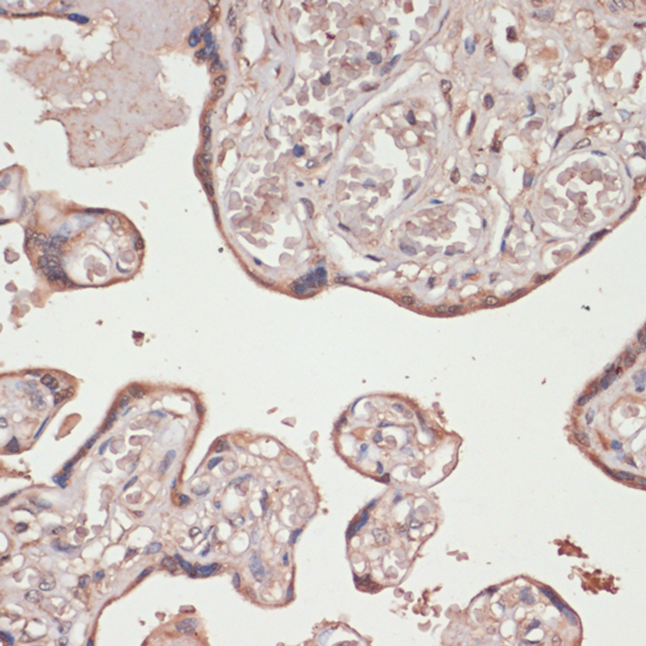 Immunohistochemistry of paraffin-embedded human placenta using TXNRD1 antibody (16-688) at dilution of 1:100 (40x lens) .