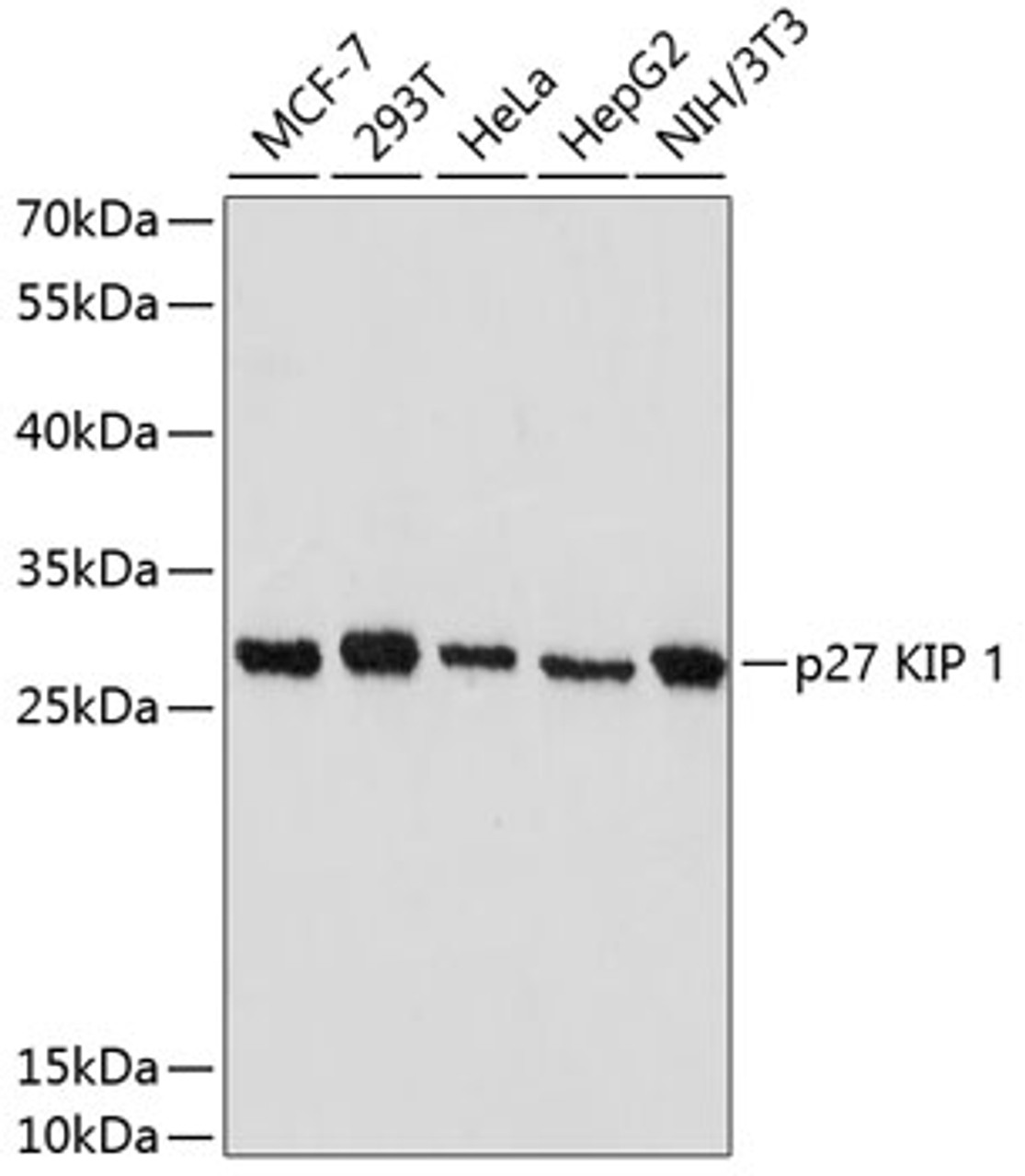 Western blot analysis of extracts of various cell lines, using p27 KIP 1 antibody (16-689) at 1:1000 dilution.<br/>Secondary antibody: HRP Goat Anti-Rabbit IgG (H+L) at 1:10000 dilution.<br/>Lysates/proteins: 25ug per lane.<br/>Blocking buffer: 3% nonfat dry milk in TBST.<br/>Detection: ECL Basic Kit.<br/>Exposure time: 90s.