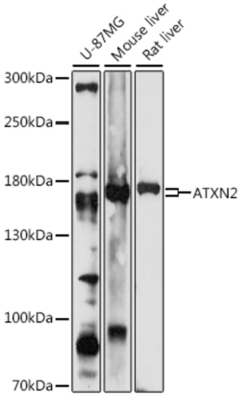 Western blot analysis of extracts of various cell lines, using ATXN2 antibody (16-703) at 1:1000 dilution. <br/>Secondary antibody: HRP Goat Anti-Rabbit IgG (H+L) at 1:10000 dilution.<br/>Lysates/proteins: 25ug per lane.<br/>Blocking buffer: 3% nonfat dry milk in TBST.<br/>Detection: ECL Enhanced Kit.<br/>Exposure time: 30s.