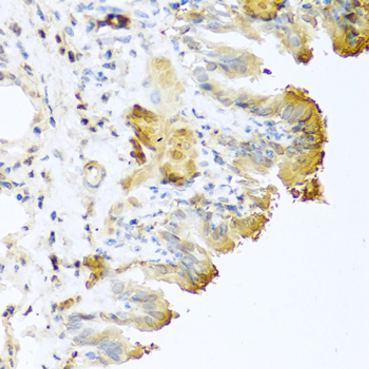 Immunohistochemistry of paraffin-embedded mouse lung using VTN antibody (16-704) at dilution of 1:100 (40x lens) .