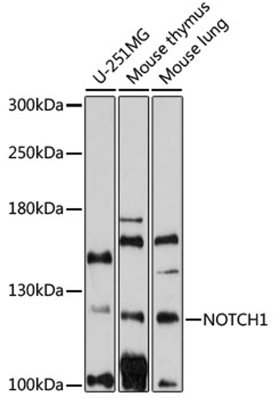Western blot analysis of extracts of various cell lines, using NOTCH1 antibody (16-708) at 1:1000 dilution.<br/>Secondary antibody: HRP Goat Anti-Rabbit IgG (H+L) at 1:10000 dilution.<br/>Lysates/proteins: 25ug per lane.<br/>Blocking buffer: 3% nonfat dry milk in TBST.<br/>Detection: ECL Basic Kit.<br/>Exposure time: 300s.