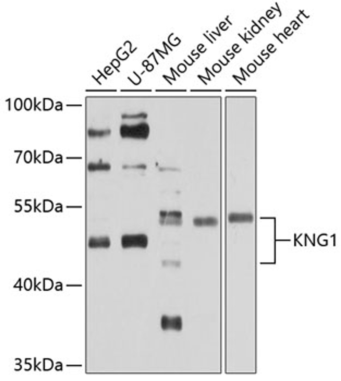 Western blot analysis of extracts of various cell lines, using KNG1 antibody (16-720) at 1:1000 dilution.<br/>Secondary antibody: HRP Goat Anti-Rabbit IgG (H+L) at 1:10000 dilution.<br/>Lysates/proteins: 25ug per lane.<br/>Blocking buffer: 3% nonfat dry milk in TBST.<br/>Detection: ECL Basic Kit.<br/>Exposure time: 30s.